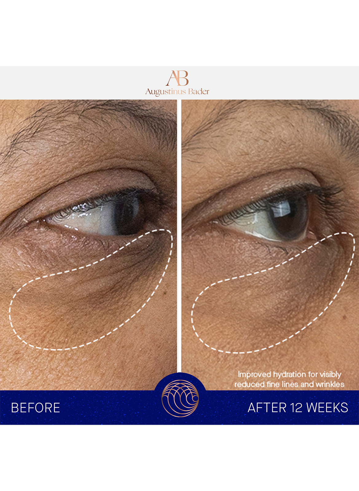 The Eye Cream Nomad AUGUSTINUS BADER No color