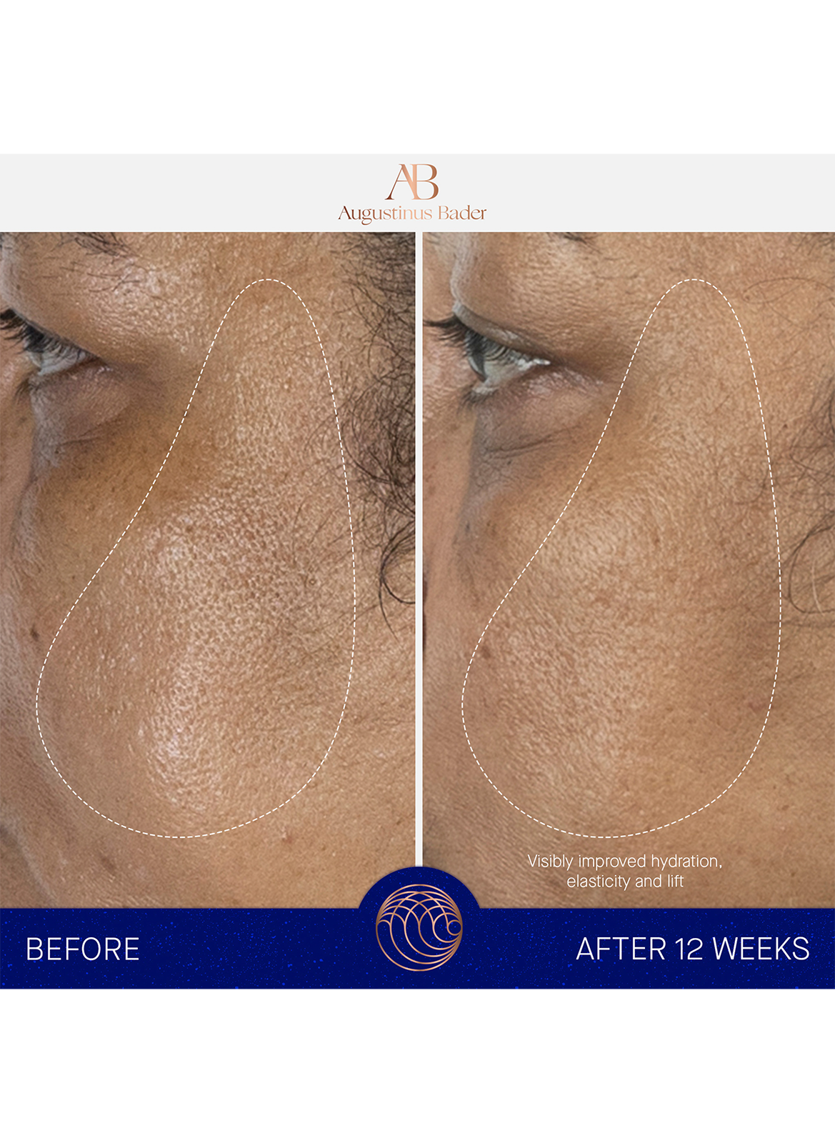 The Serum Nomad AUGUSTINUS BADER No color