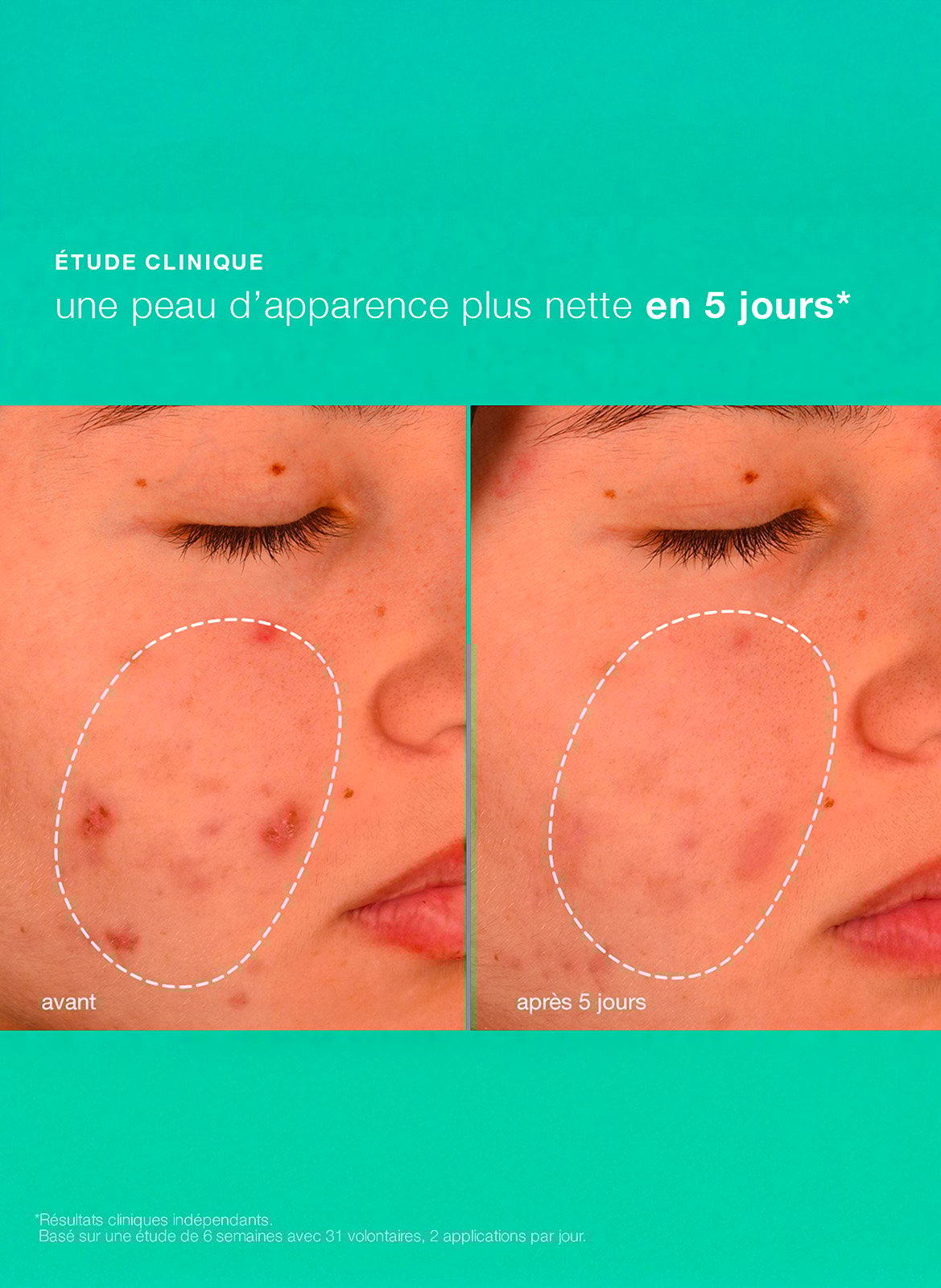 Breakout biotic moisturizer DERMALOGICA No color