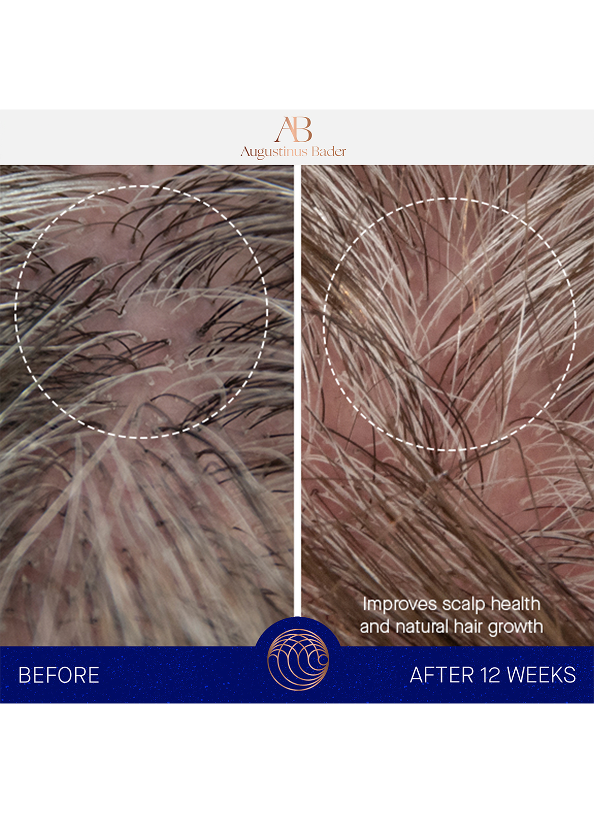 The Conditioner AUGUSTINUS BADER No color