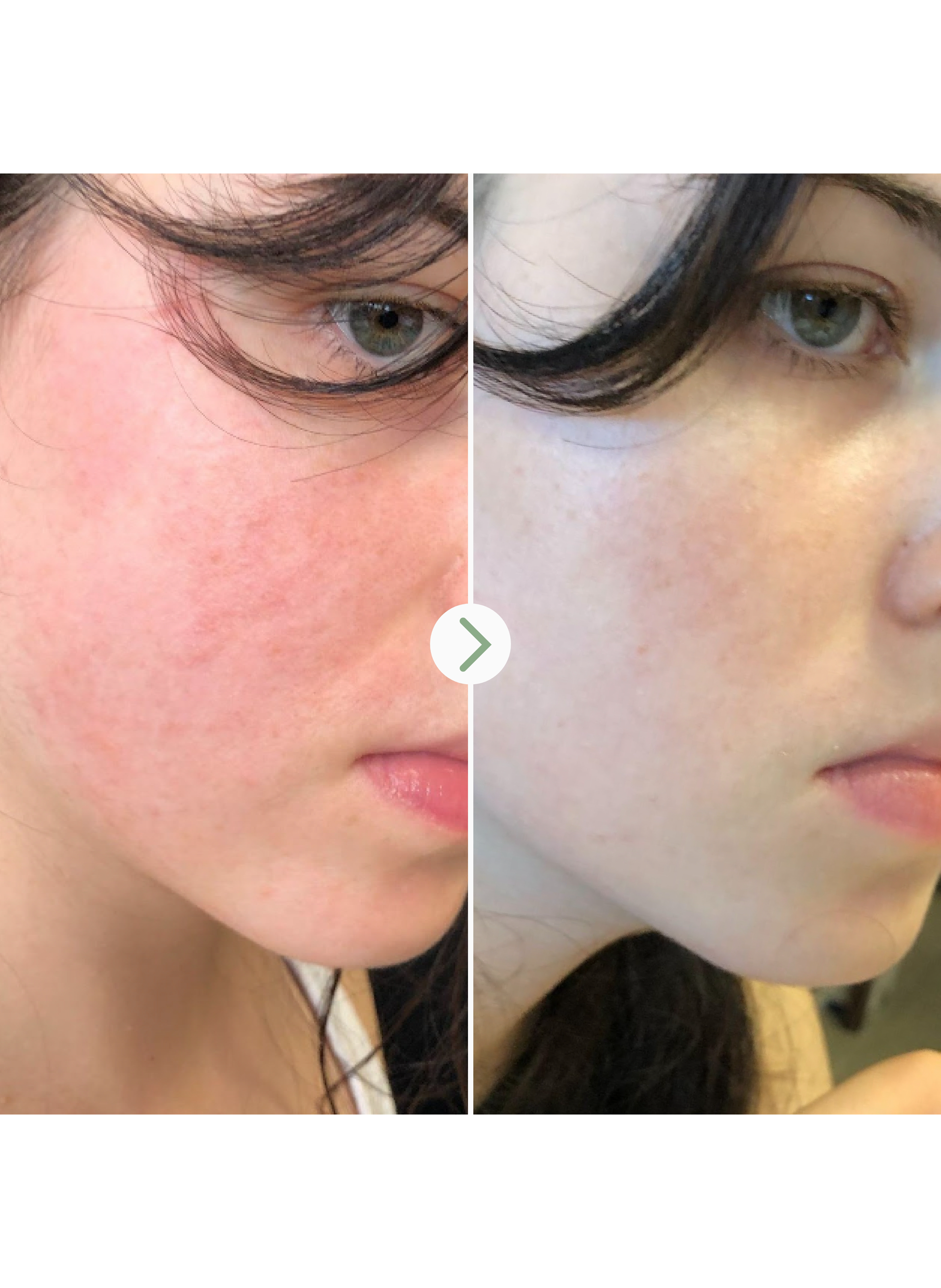 The Light Fantastic - Face Oil with Ceramides PAI No color