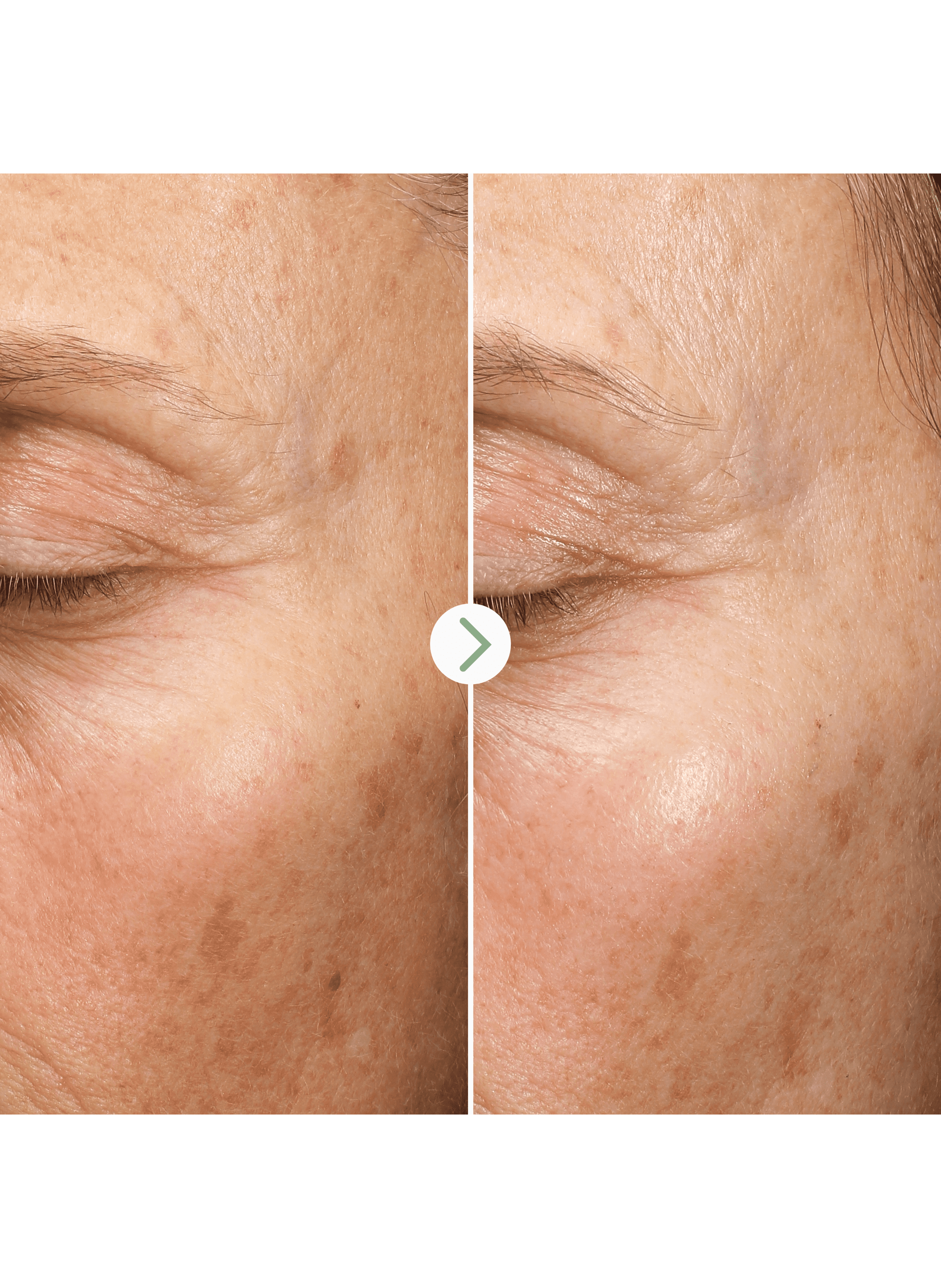 Fade Forward™ - Anti-Spot Serum PAI No color