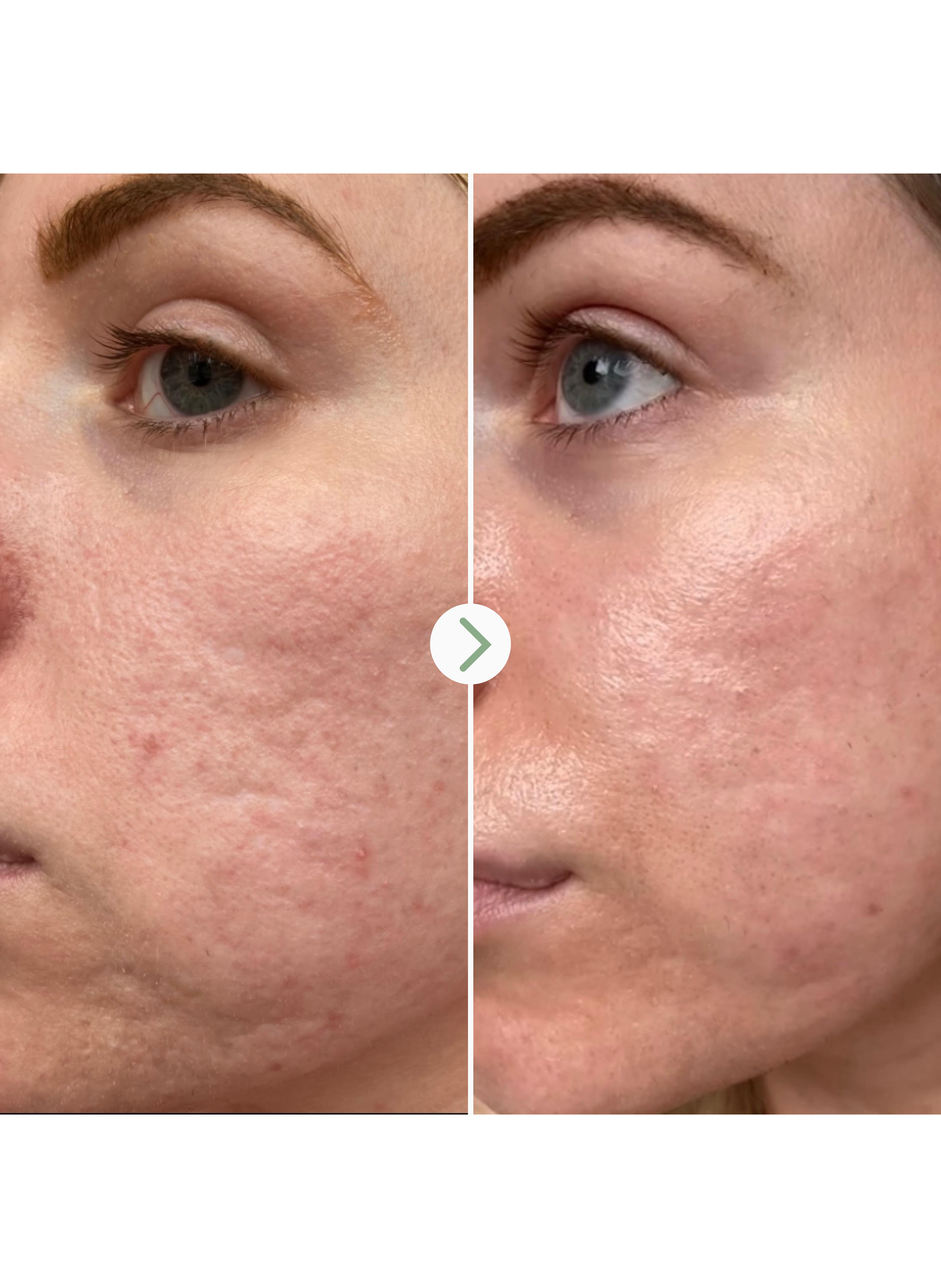 Hydrating Booster - Hyaluronic Acid 0.3% PAI No color