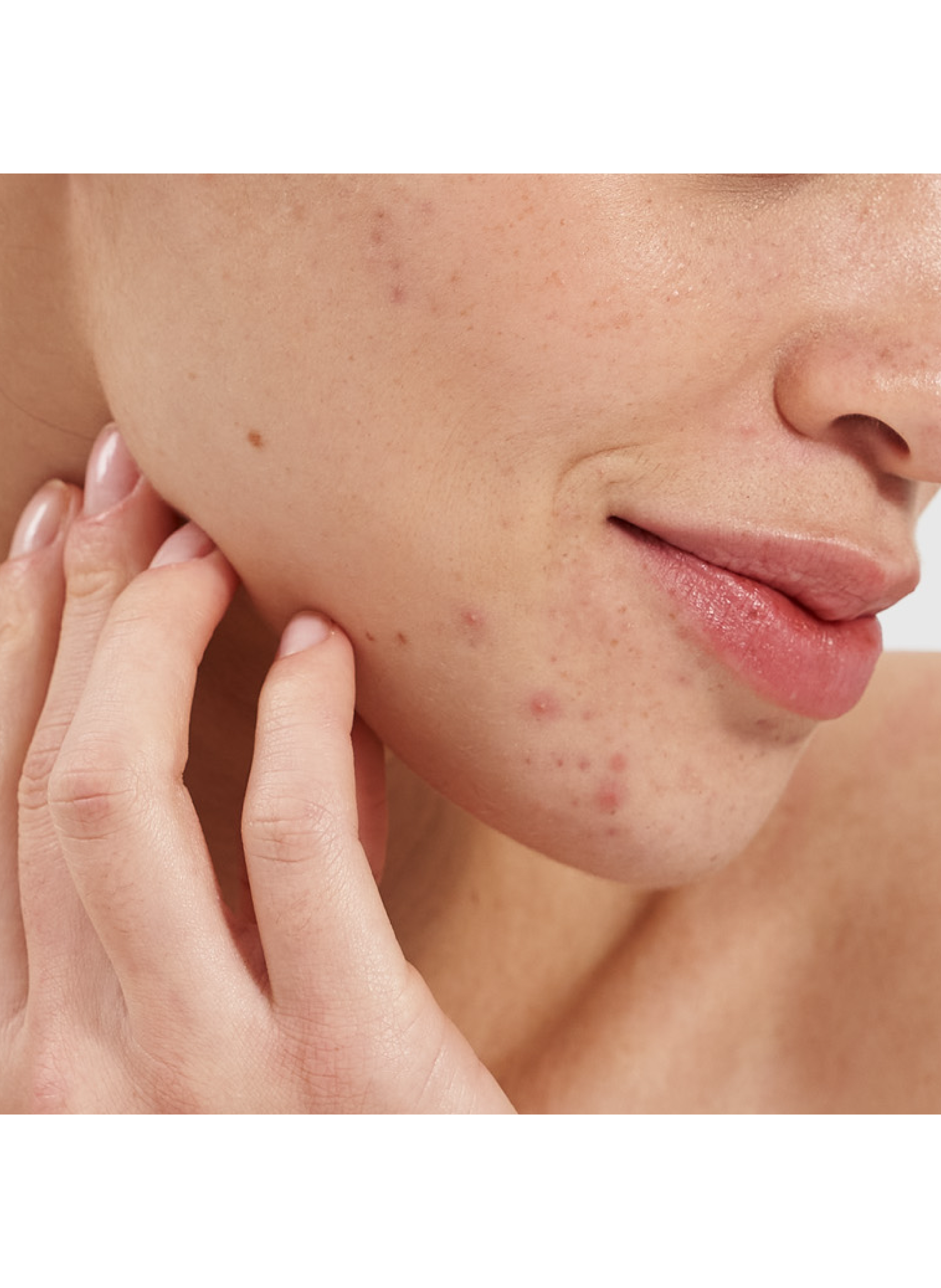 Purifying Booster - Salicylic Acid 2% PAI No color