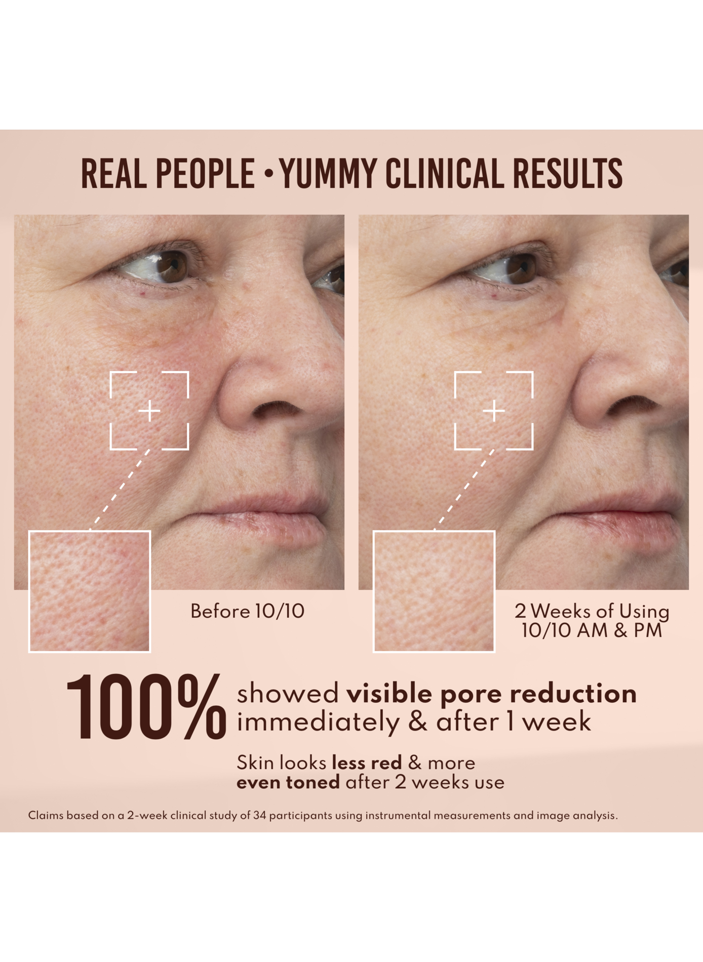 Yummy Skin 10/10 Barrier Boost DANESSA MYRICKS No color