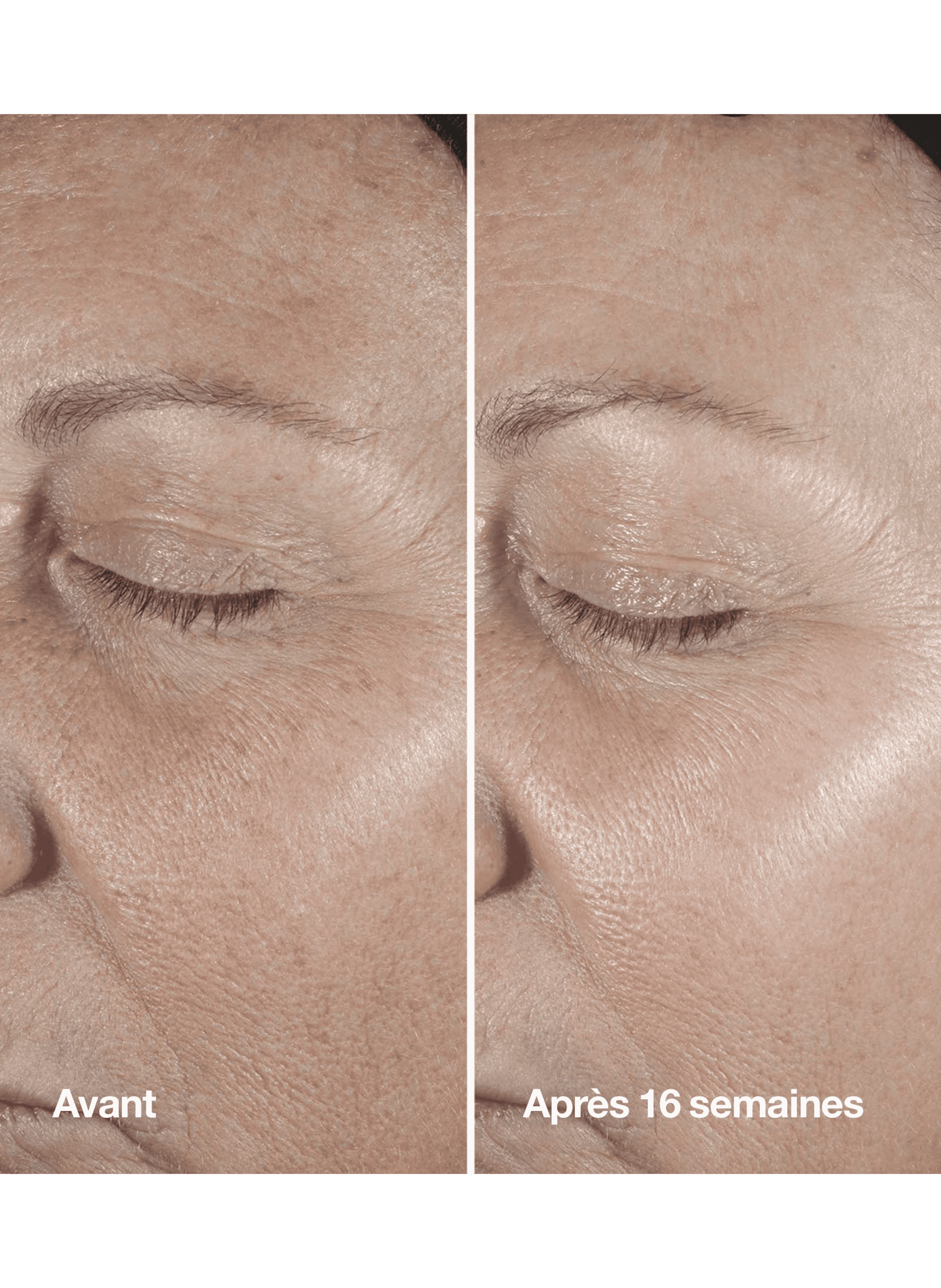 Smart Clinical Repair™ Sérum - Sérum Correcteur Anti-rides CLINIQUE No color