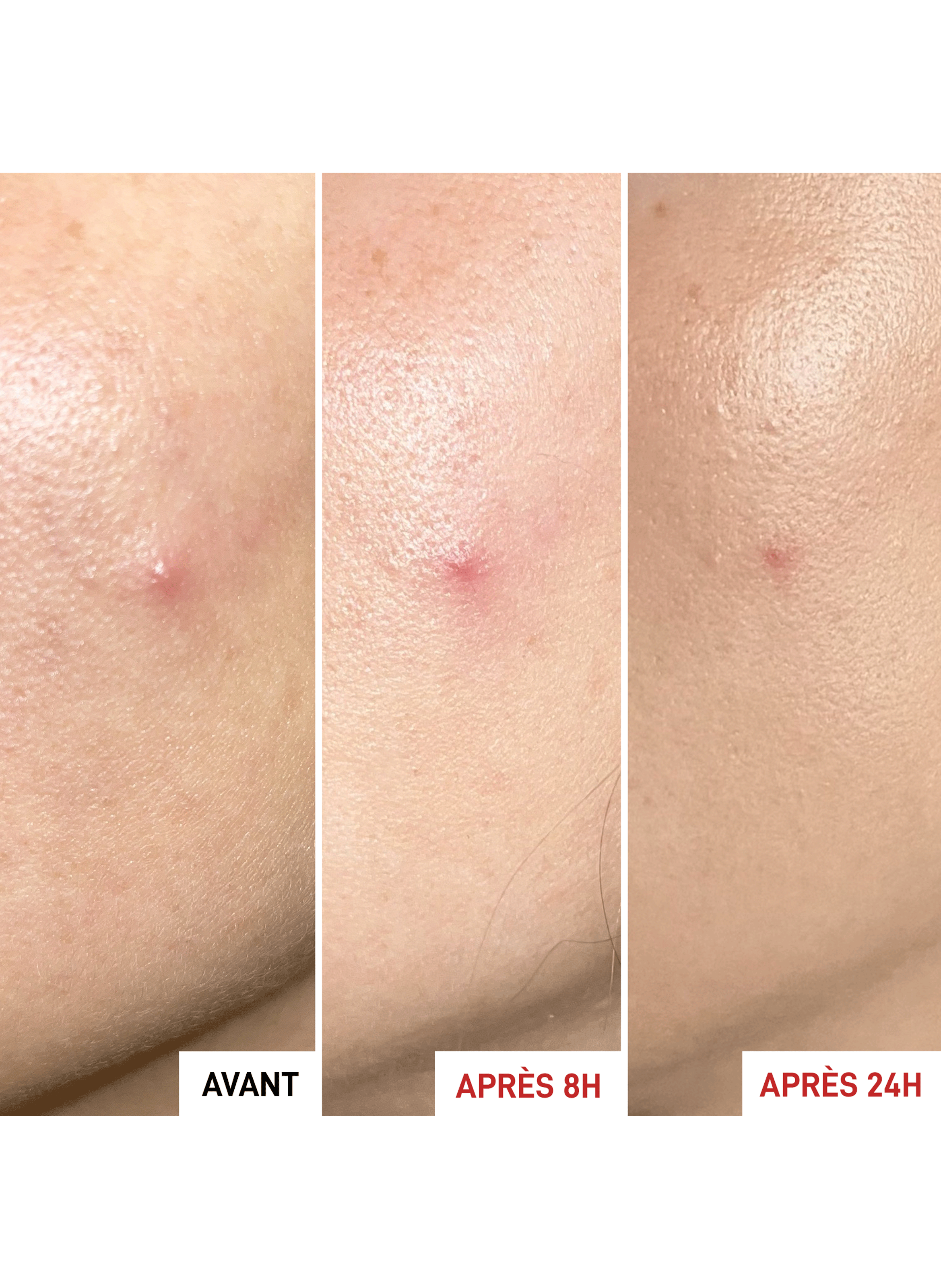 Centella SOS Patch ERBORIAN No color