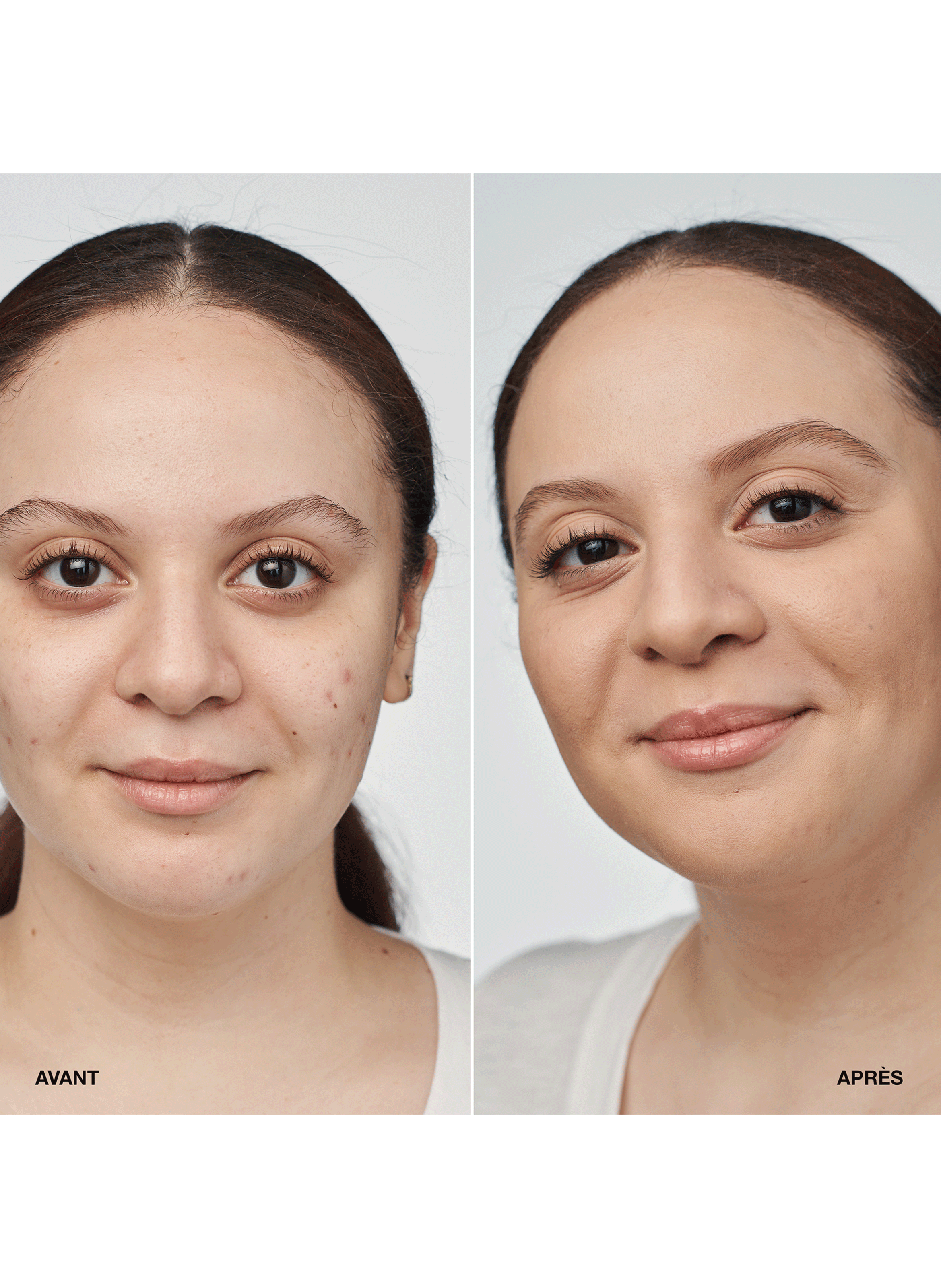 Serum Foundation SPF 20 CLINIQUE Wn 04 bone