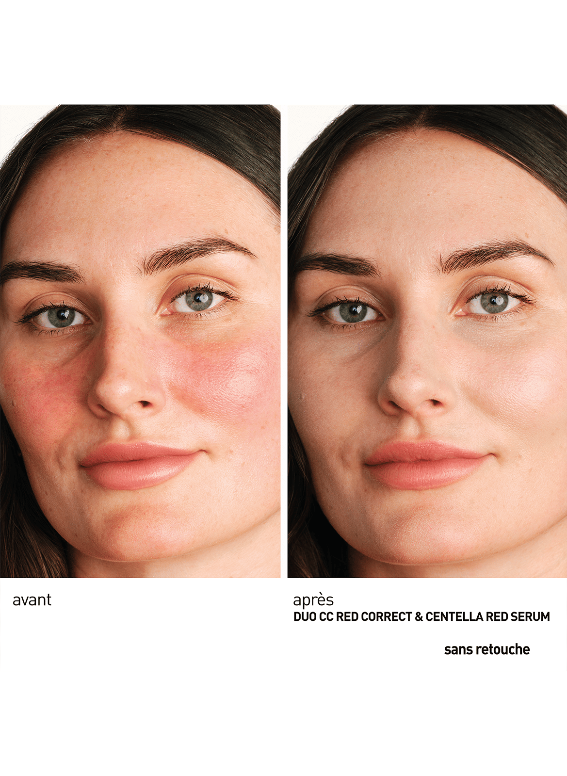 Centella Red Serum - Concentré apaisant immédiat No color