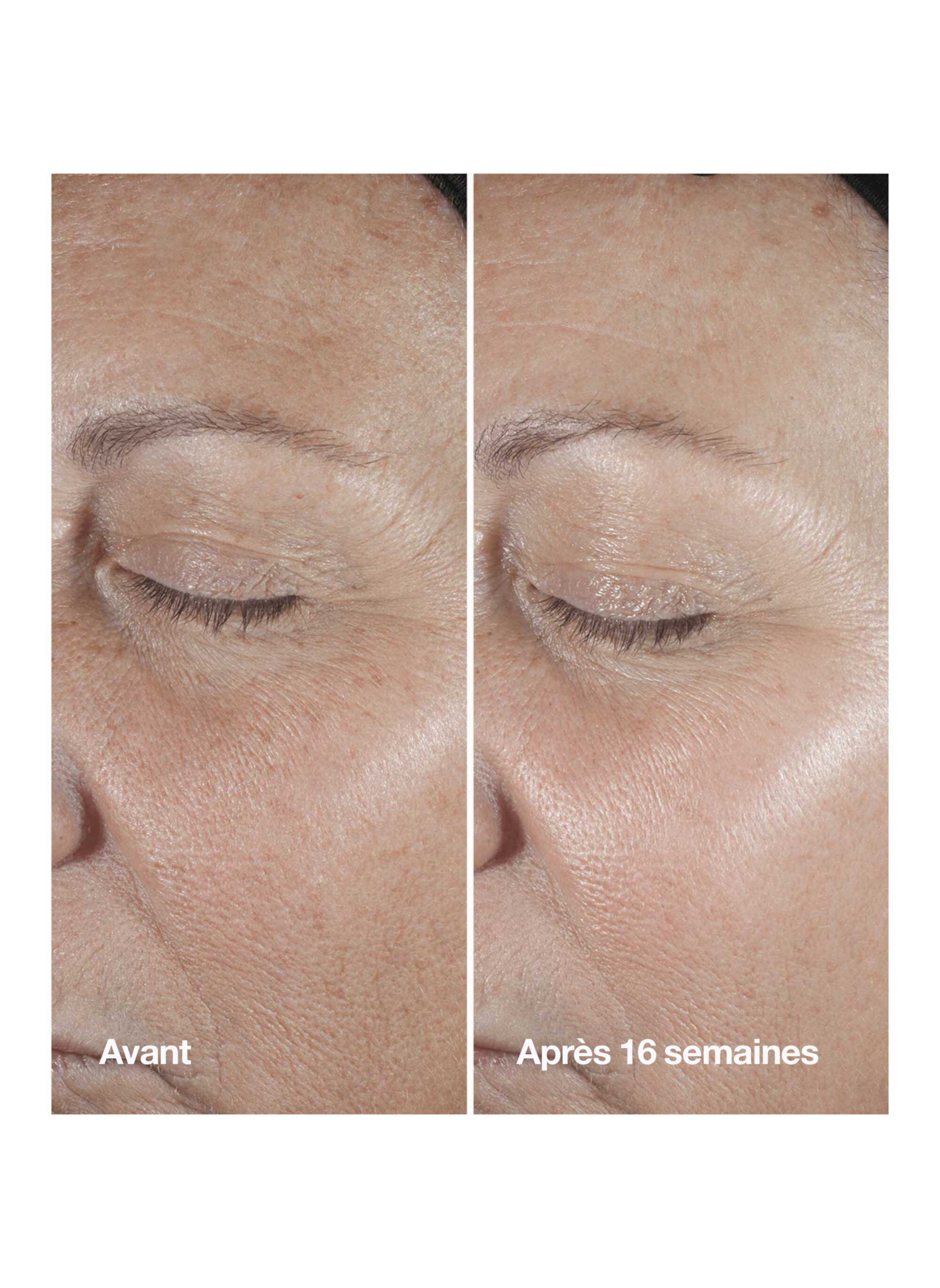 Smart Clinical Repair™ - Anti-aging & Firming Hydration Set CLINIQUE No color
