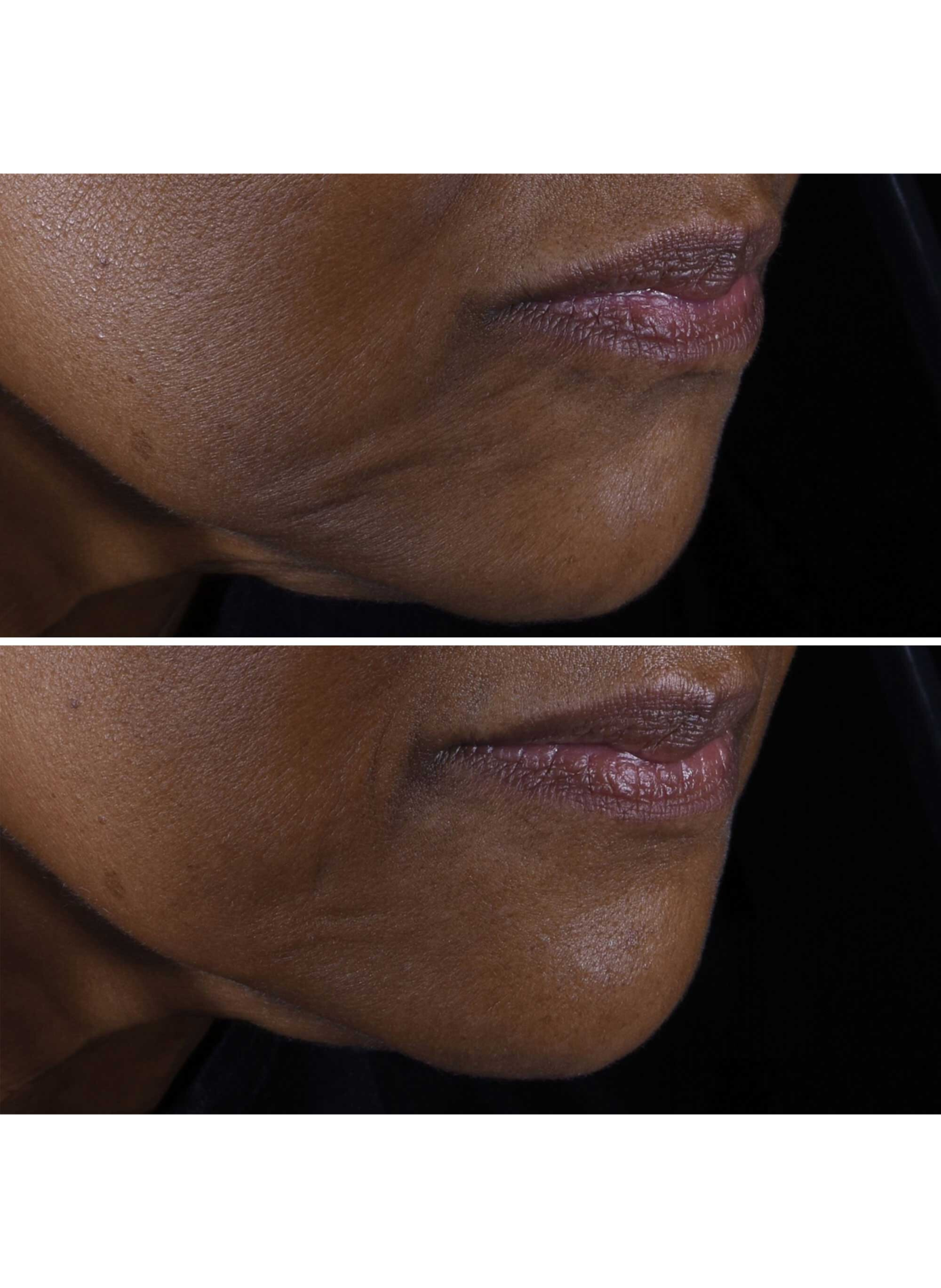 Smart Clinical Repair™ - Anti-aging & Firming Hydration Set CLINIQUE No color
