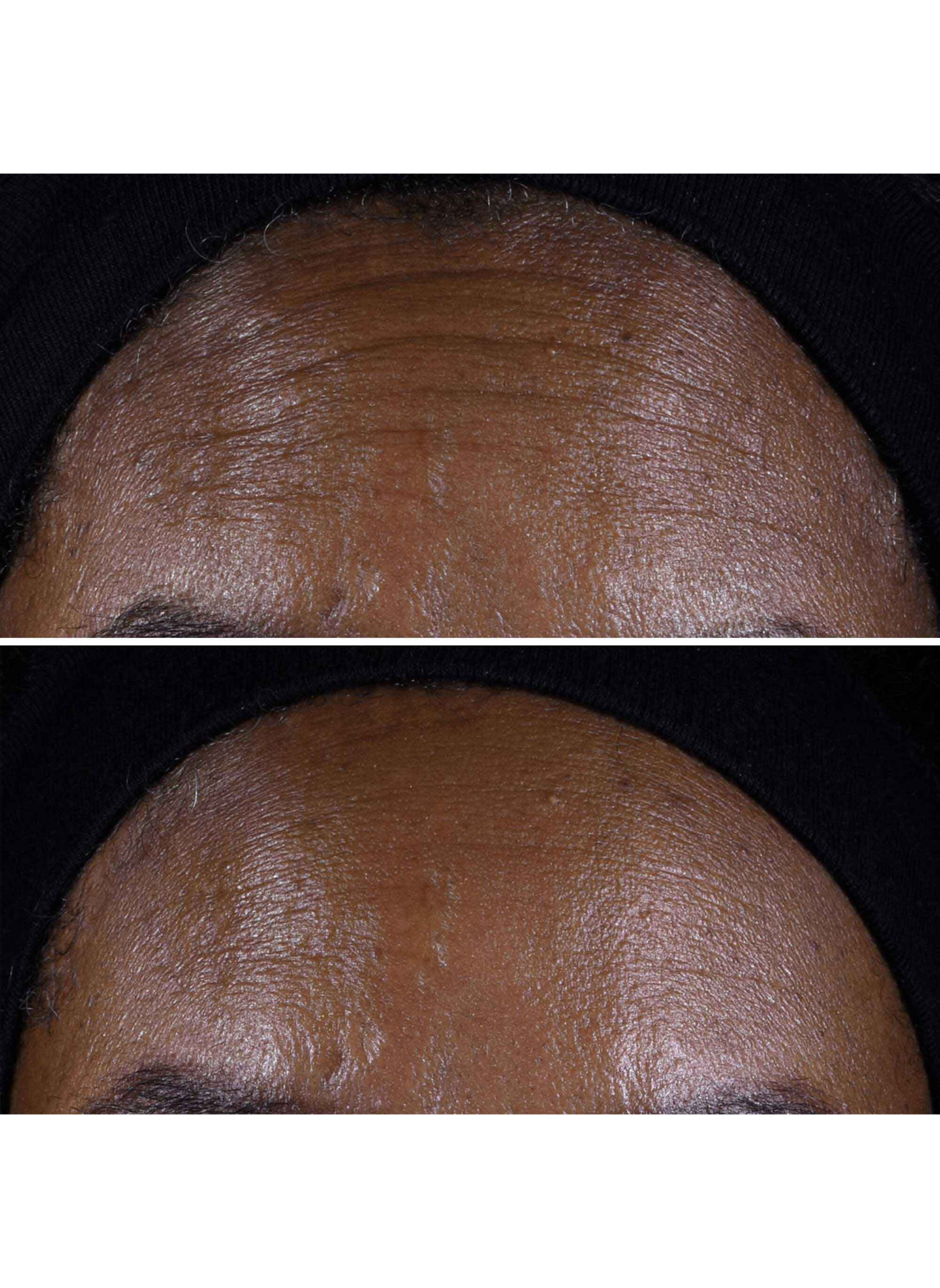 Smart Clinical Repair™ - Anti-aging & Firming Hydration Set CLINIQUE No color