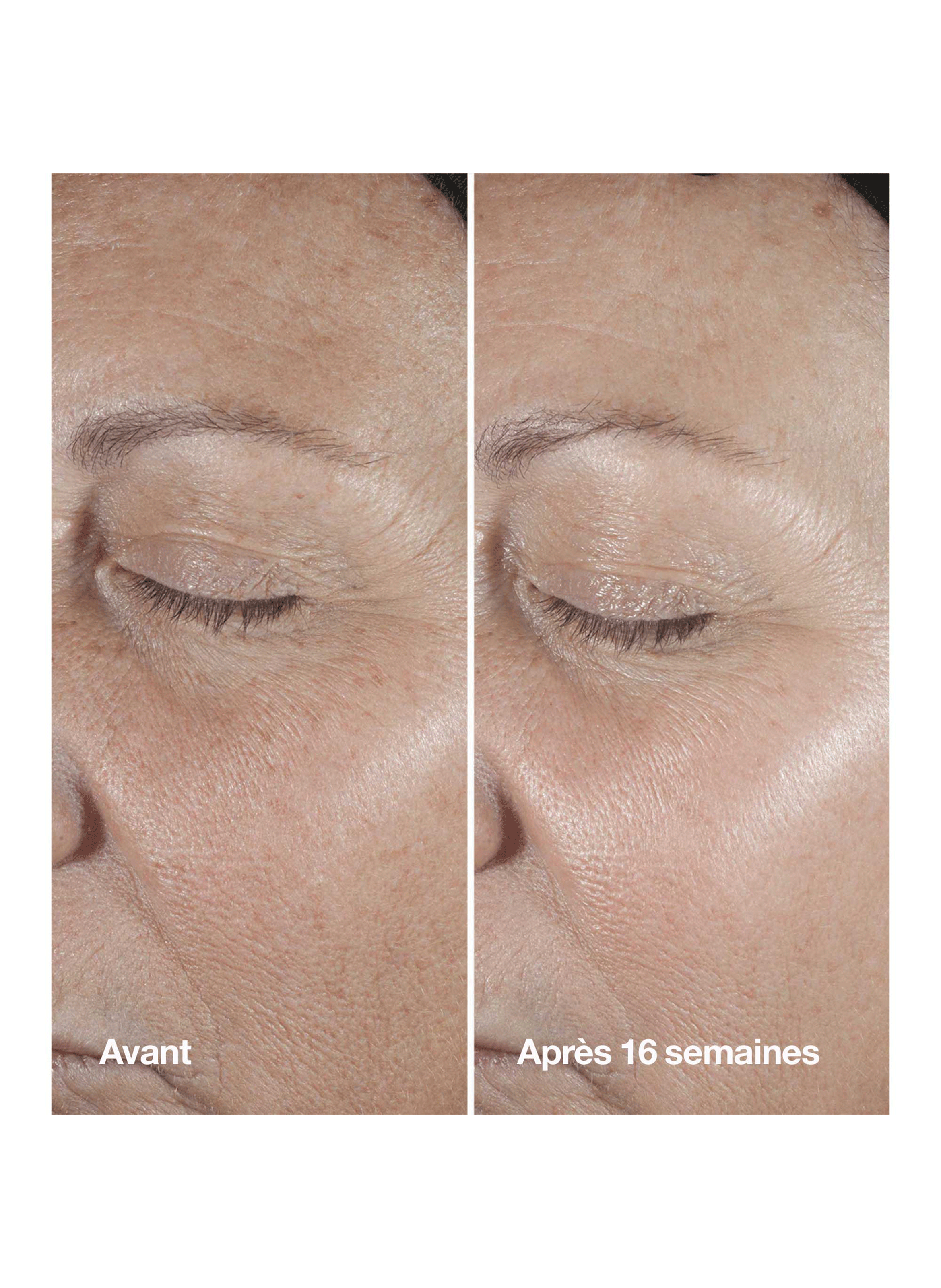 Smart Clinical Repair(TM) Sérum - Sérum Correcteur Anti-rides No color