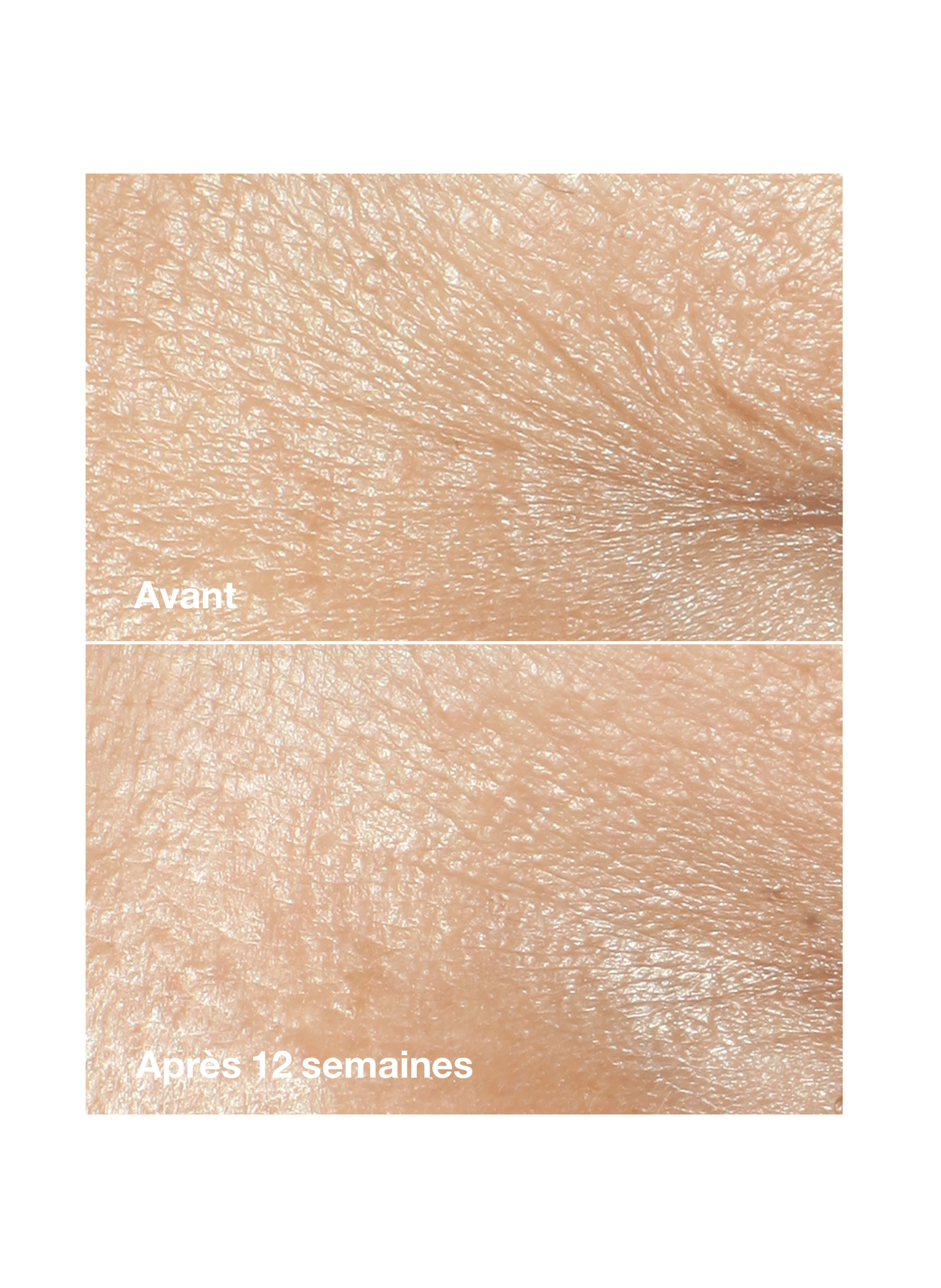 Smart Clinical Repair(TM) - Crème correctrice anti-rides CLINIQUE No color