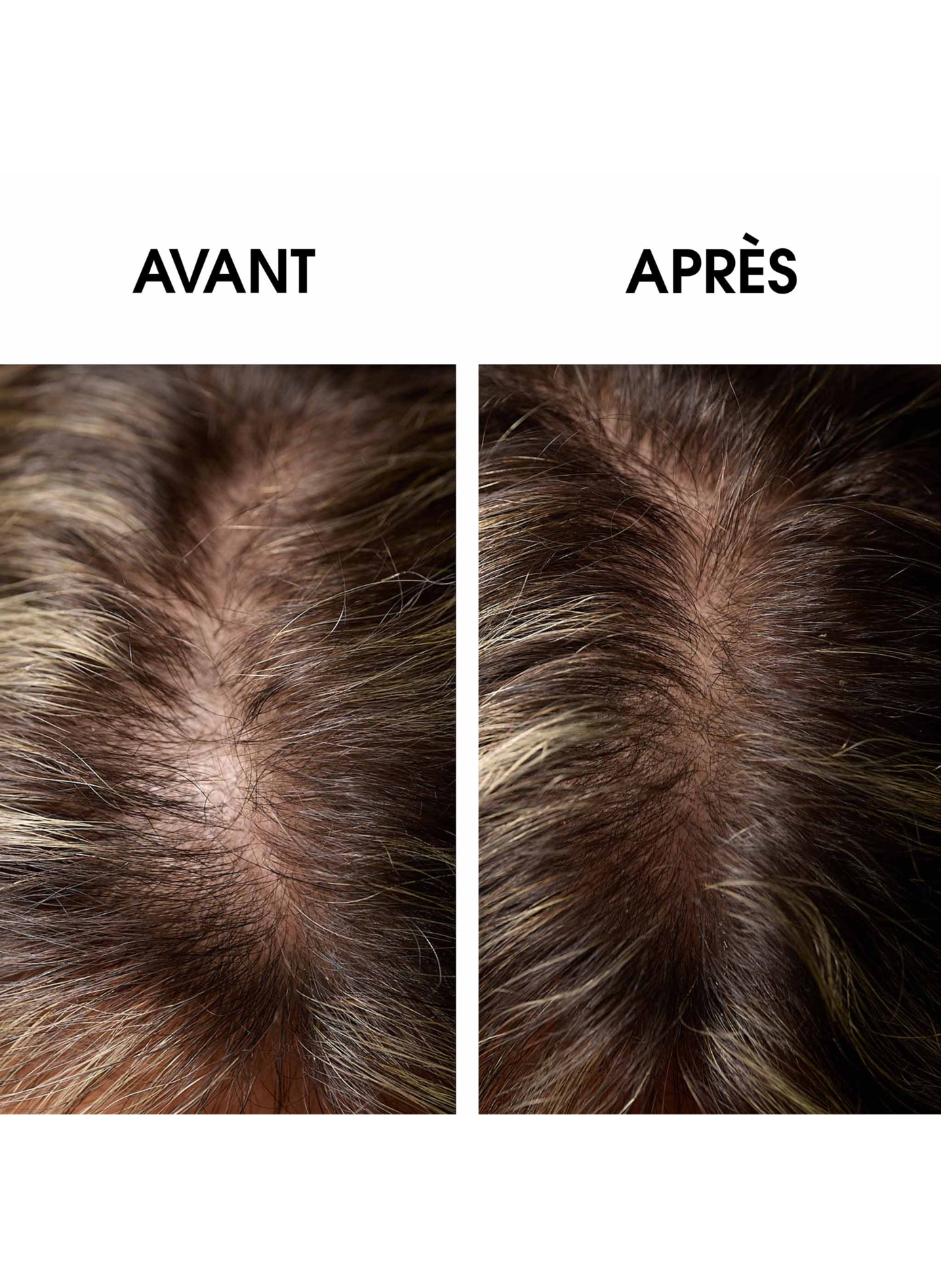 Régénerescence naturelle LEONOR GREYL No color