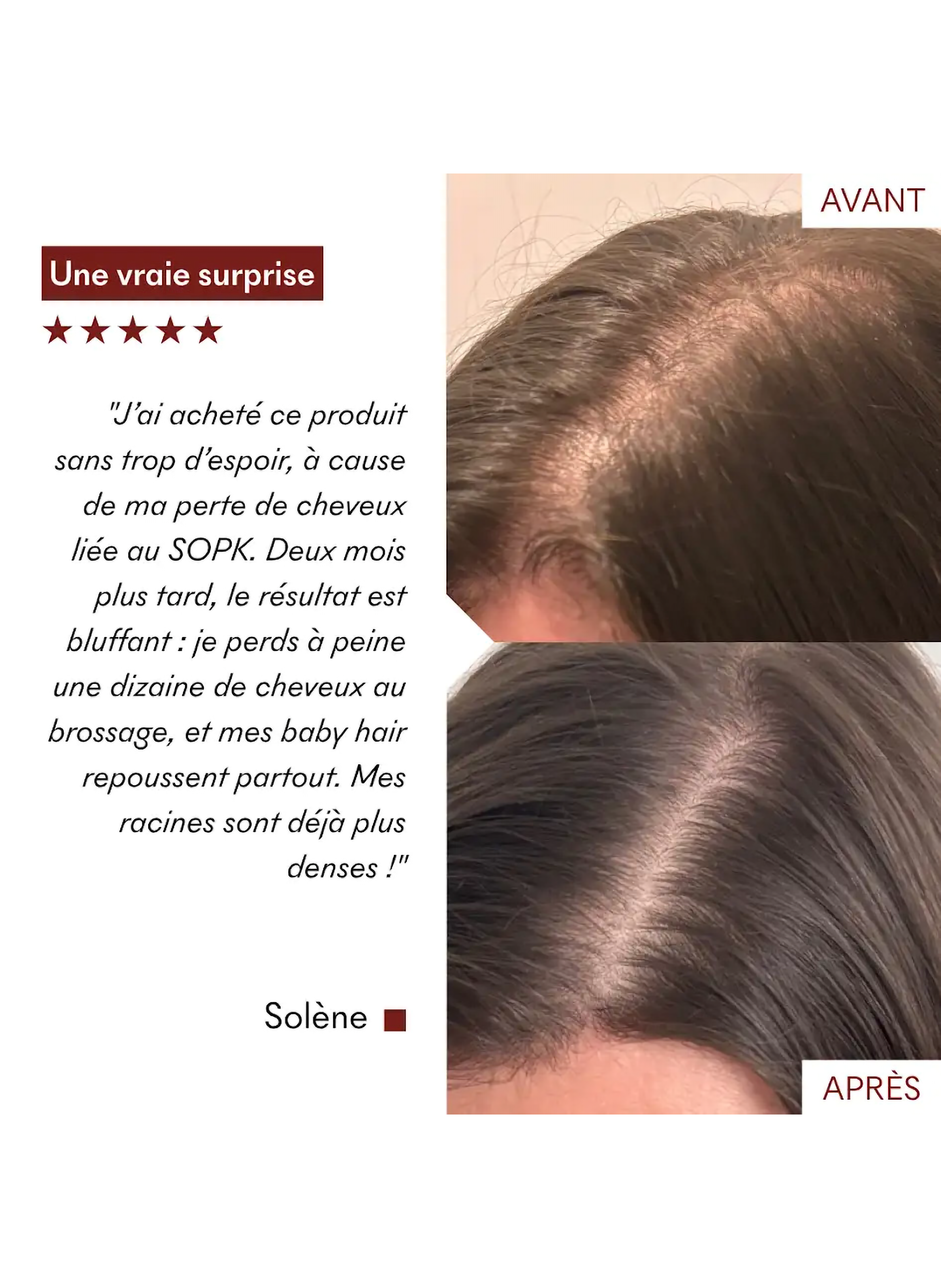 Sérum Anti-Chute Tricho-Boost MAKE MY MASK No color