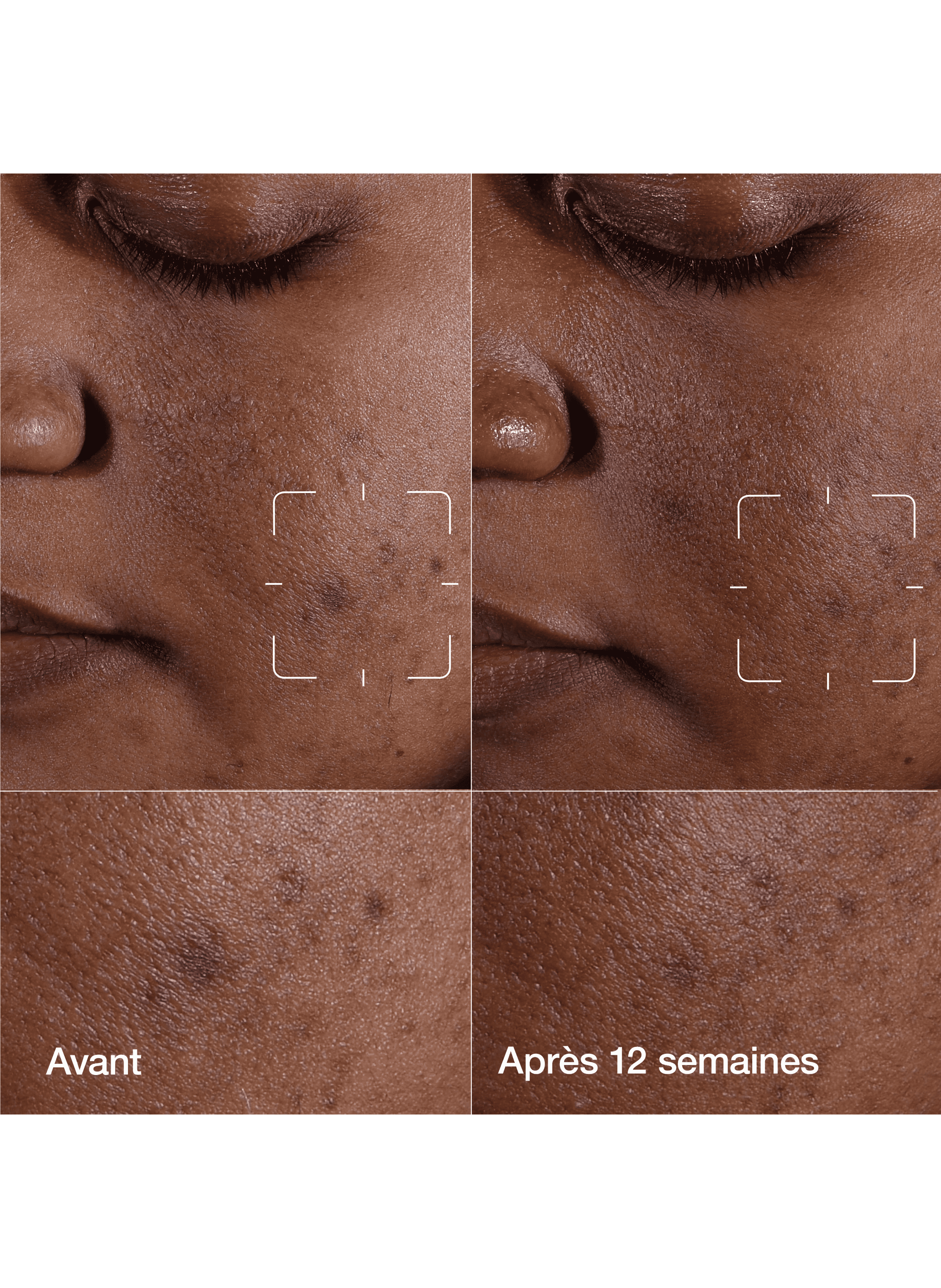 Even Better Clinical™ - Sérum Illuminateur Anti-taches CLINIQUE No color