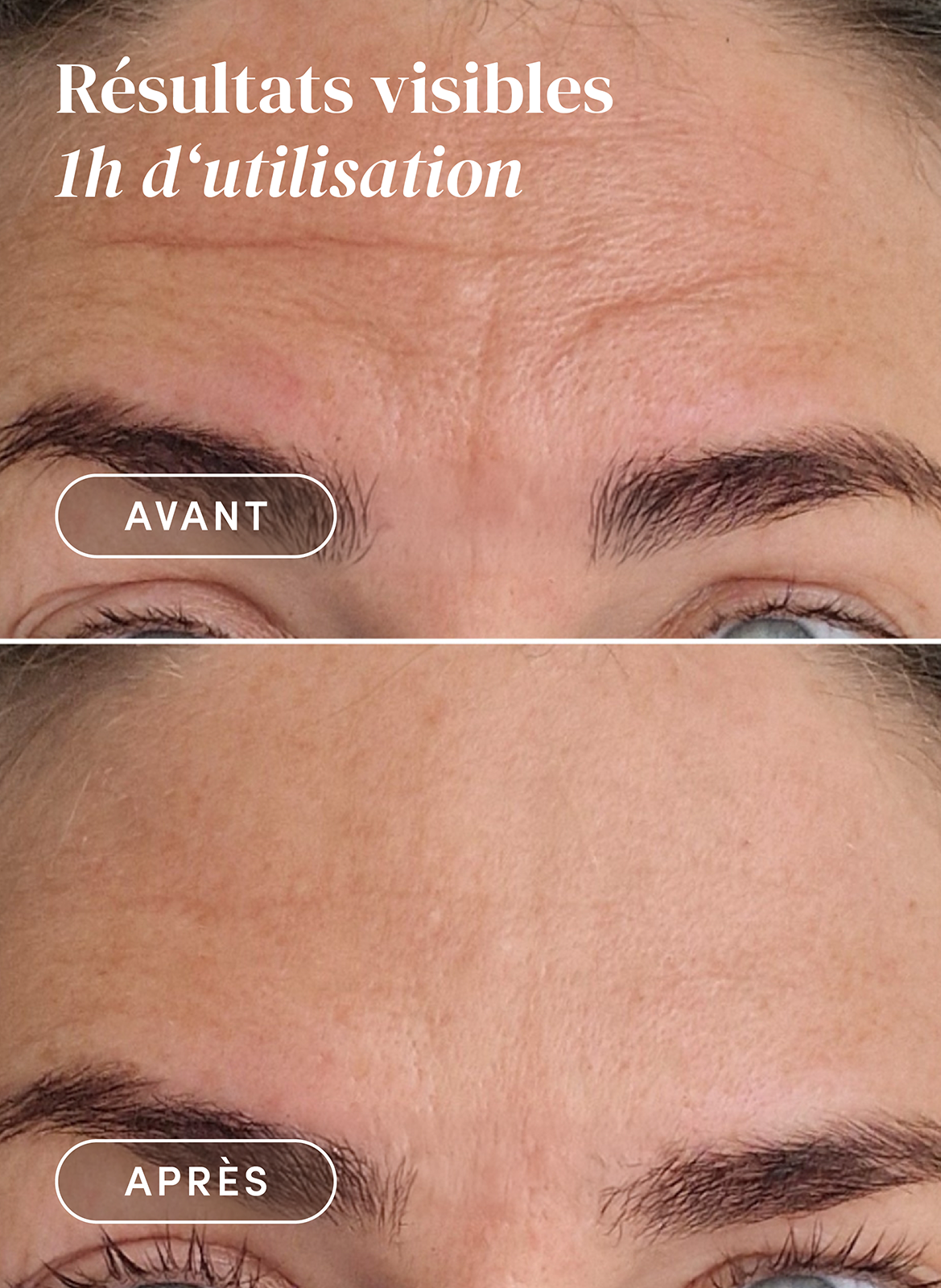 Pad front réutilisable à l’acide hyaluronique APRICOT No color