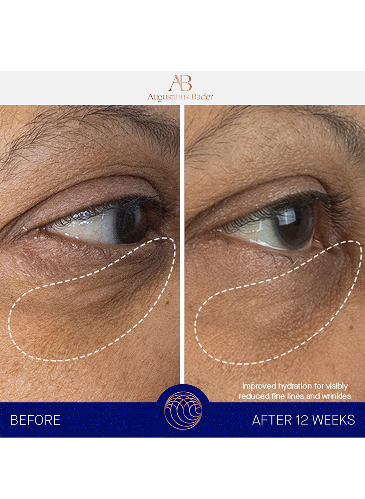 The Eye Cream Complete Set AUGUSTINUS BADER No color