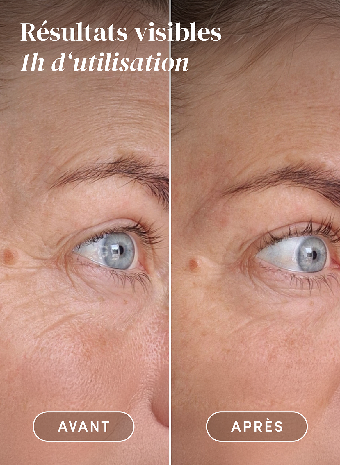 Pads yeux et tempes réutilisables à l’acide hyaluronique APRICOT No color