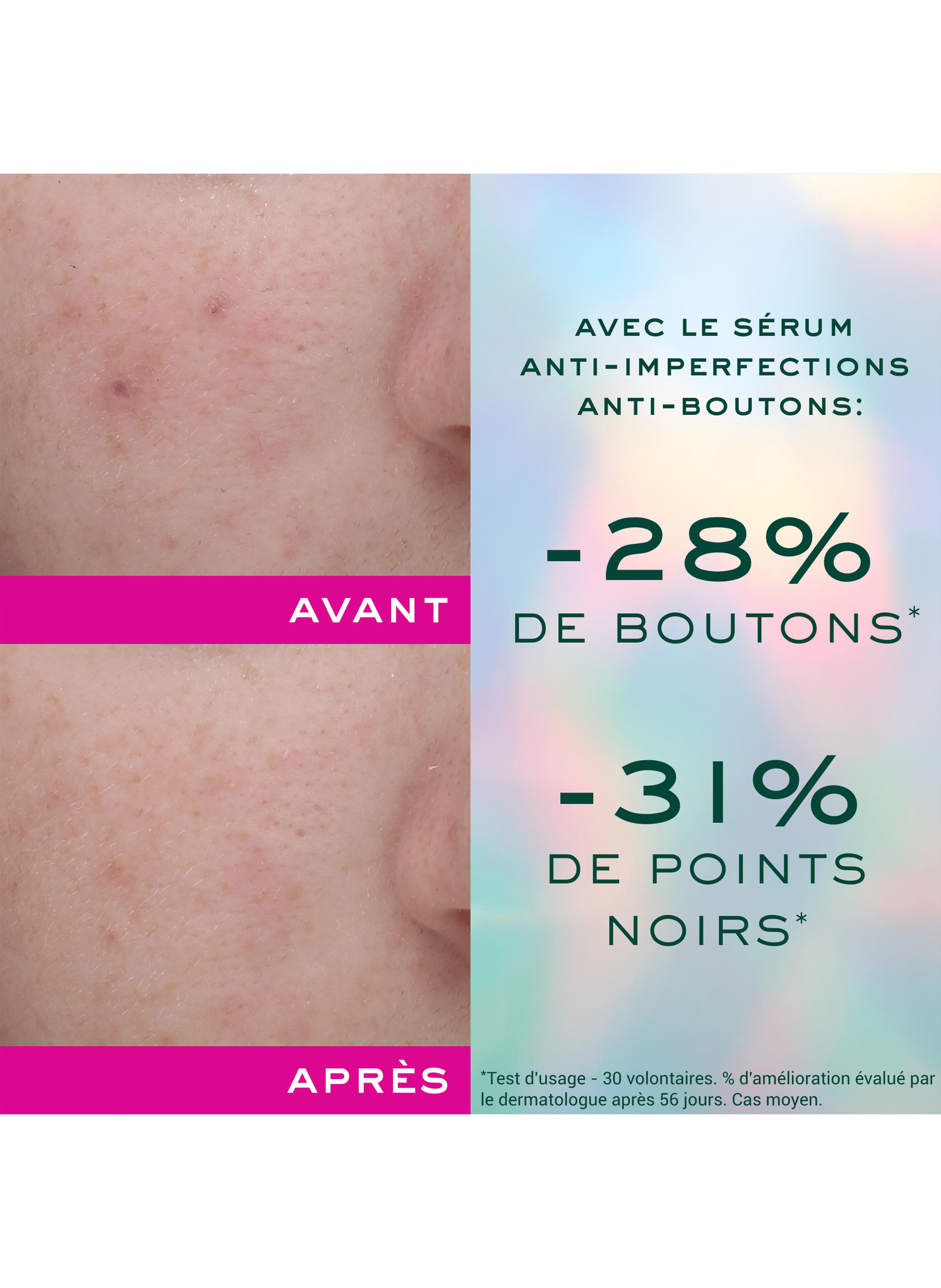 Sérum Anti-Imperfections Anti-Boutons - Zinc Power NUXE No color