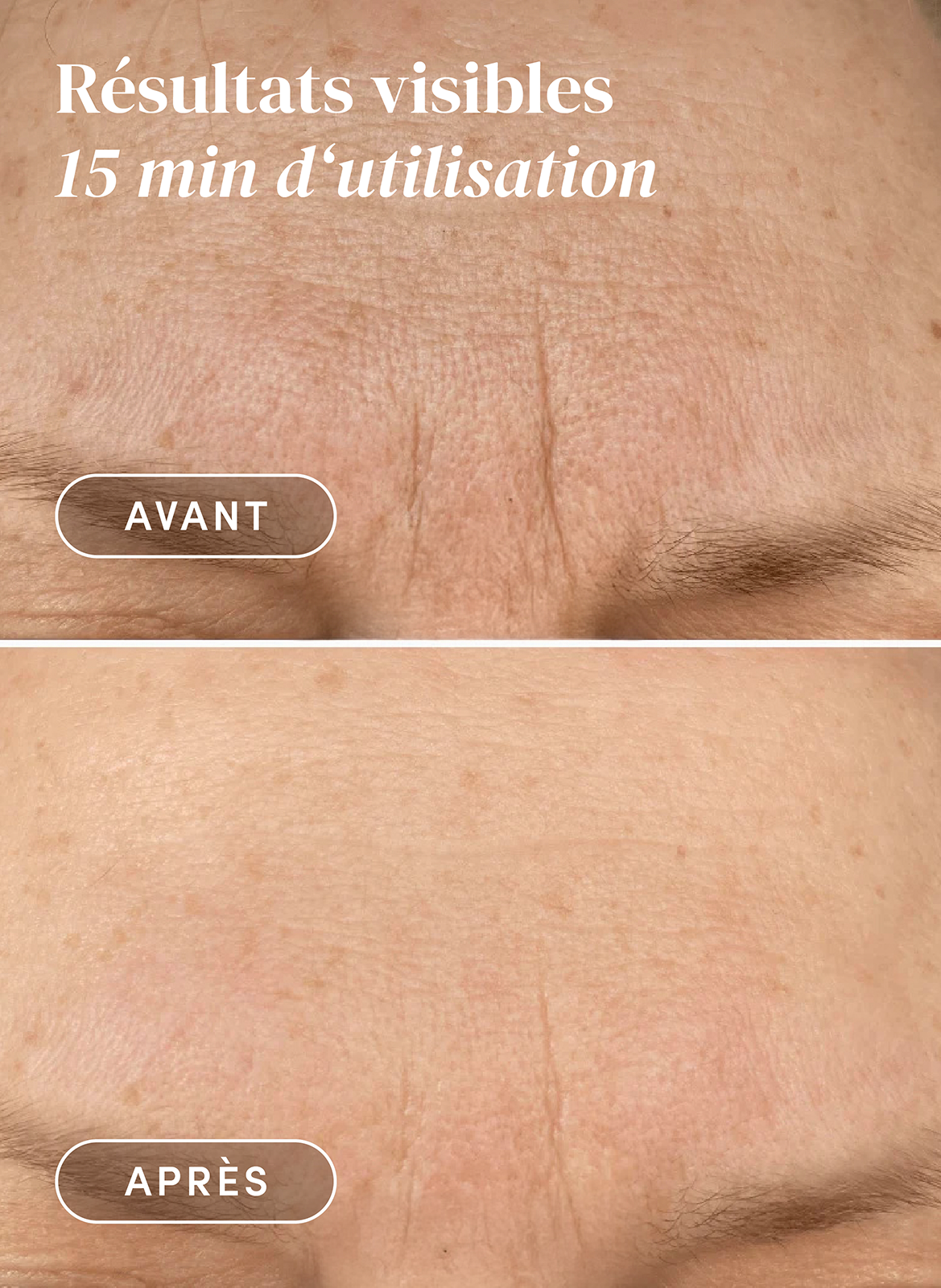 Pad front réutilisable à la vitamine C APRICOT No color