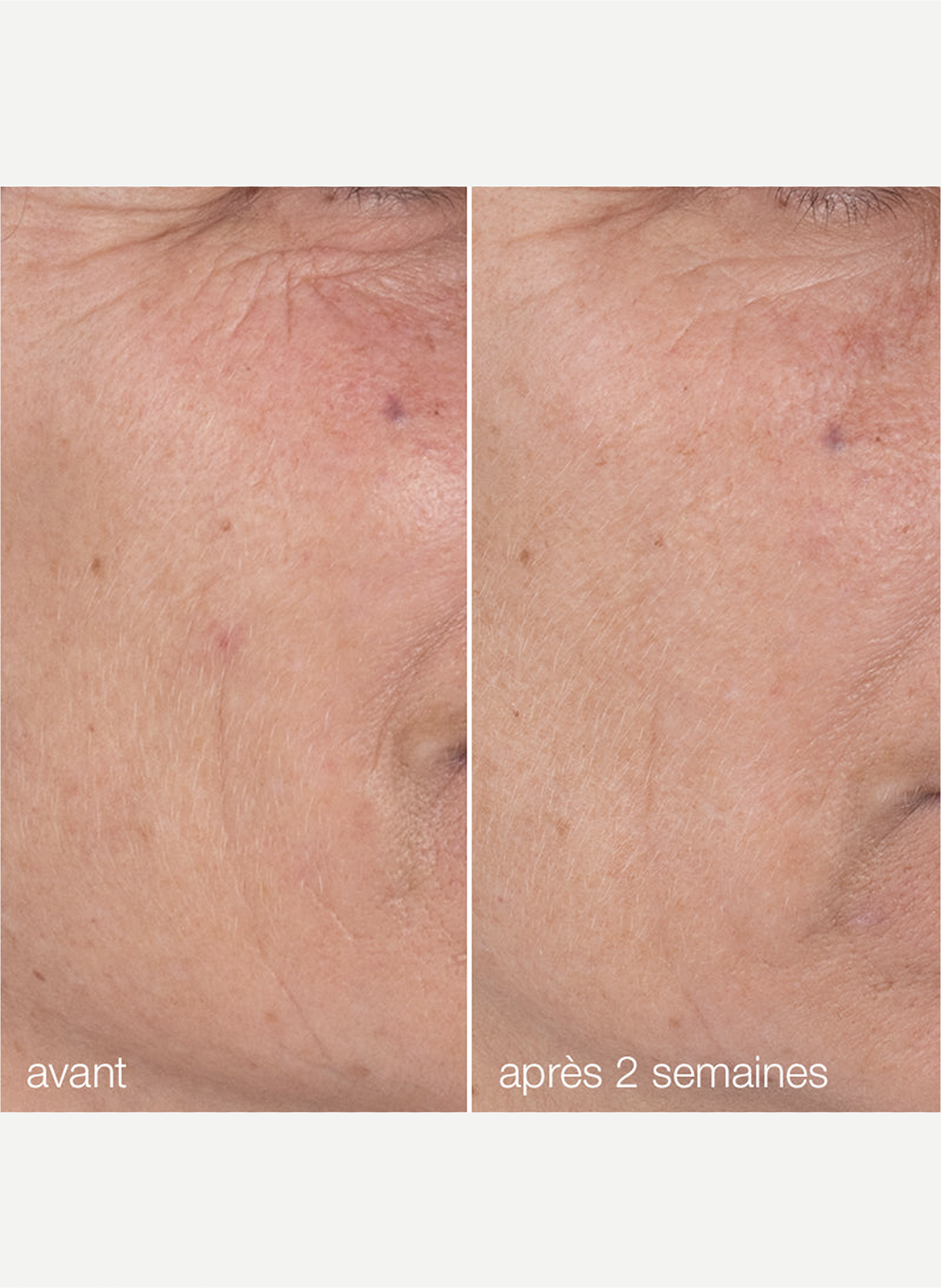 Dynamic skin retinol serum DERMALOGICA No color