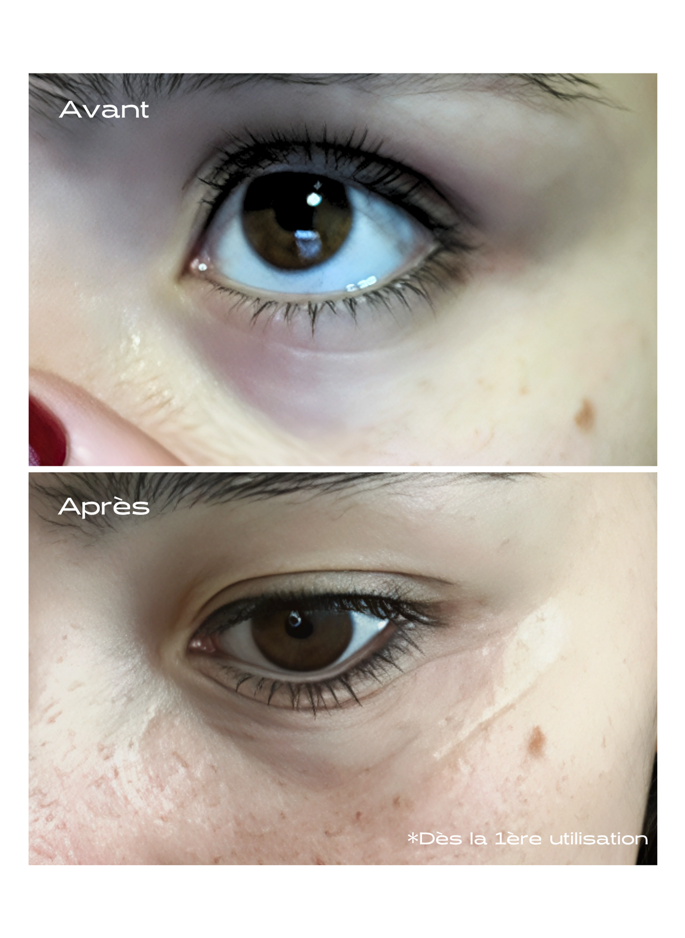 Patch Contour des Yeux Microneedling KOSMOPELLIS No color