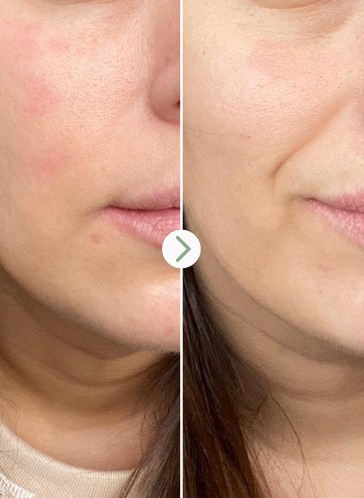 Partners in Calm - Cleansing and Hydrating Kit No color