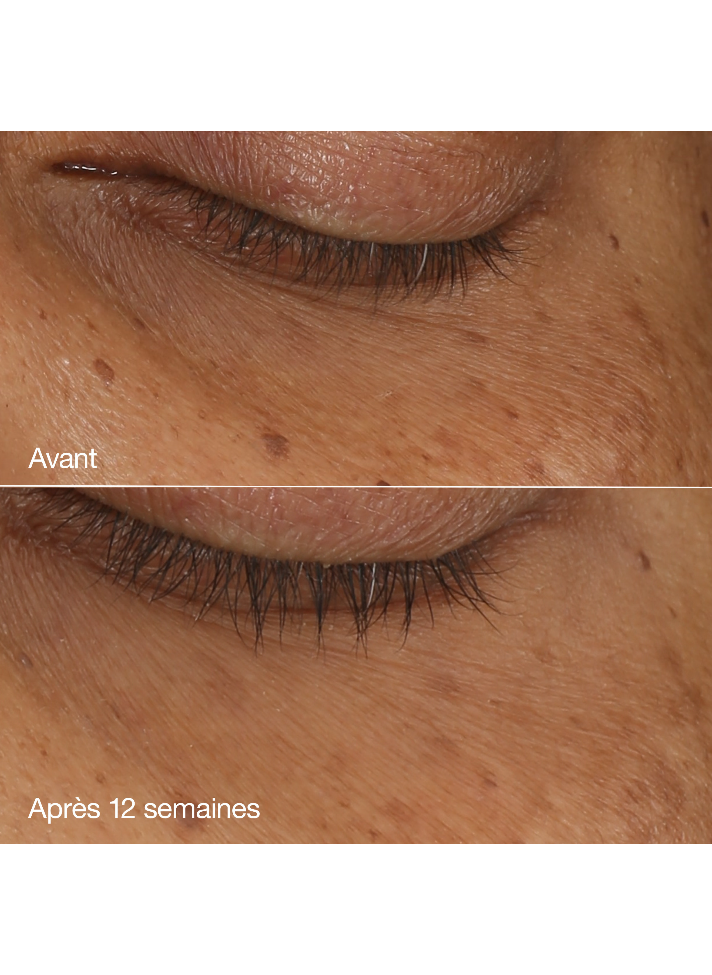 All About Eyes - Sérum yeux concentré illuminateur CLINIQUE No color