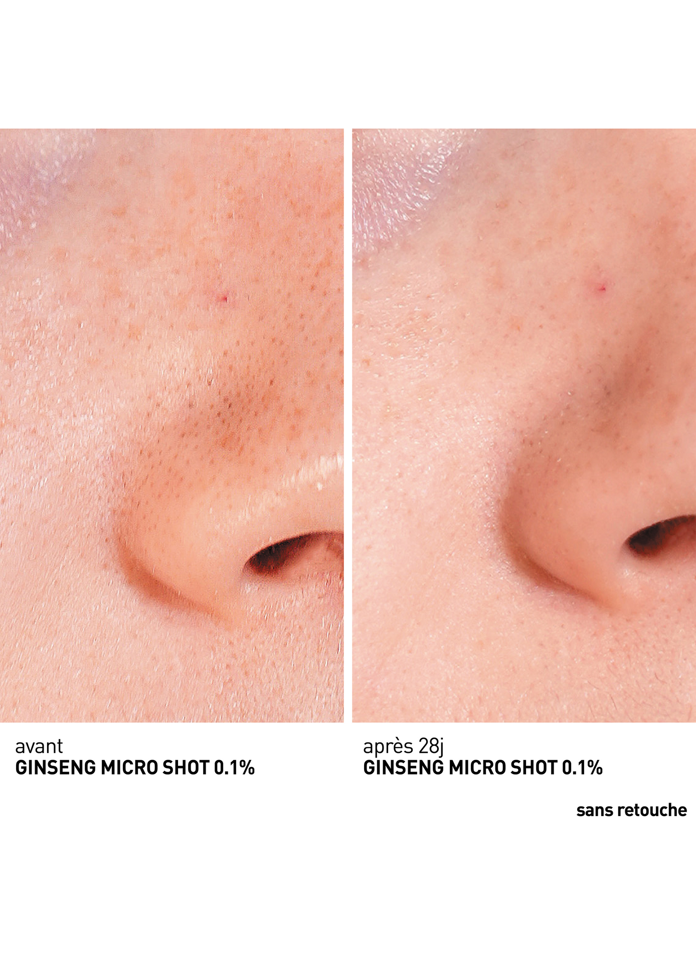 Ginseng Micro Shot Starter 0.1 - Suero microinfusión retexturizante (concentración de espículas 0.1%) ERBORIAN No color
