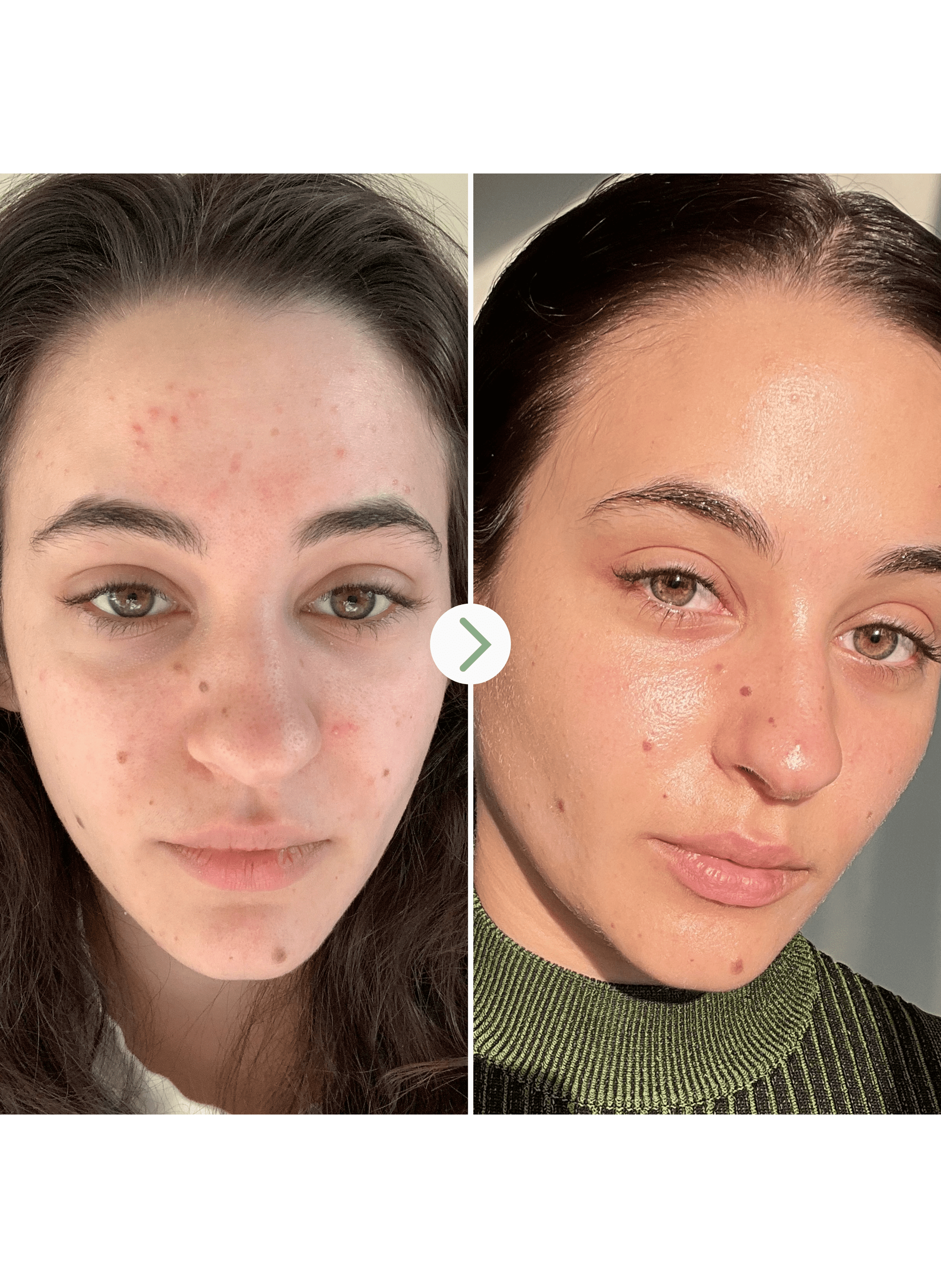 Carbon Star - Detoxifying Night Oil for the Face PAI No color