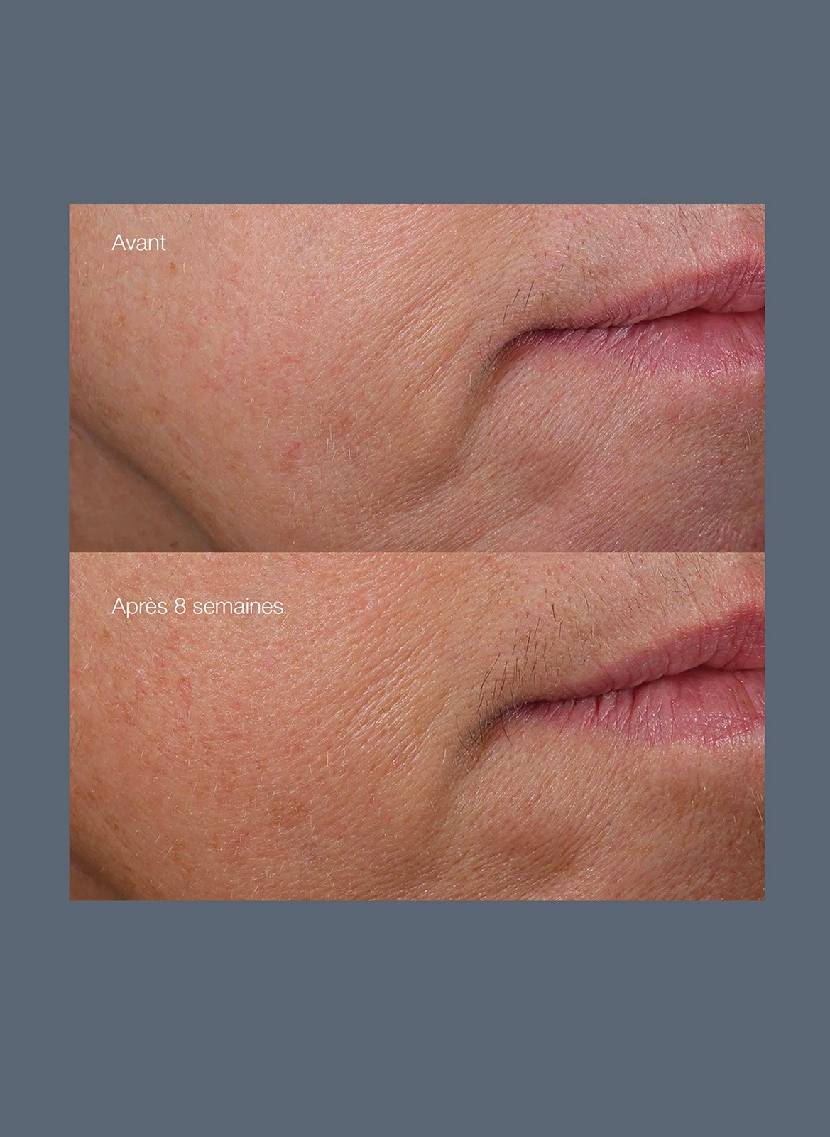 Phyto Nature Firming Serum DERMALOGICA No color