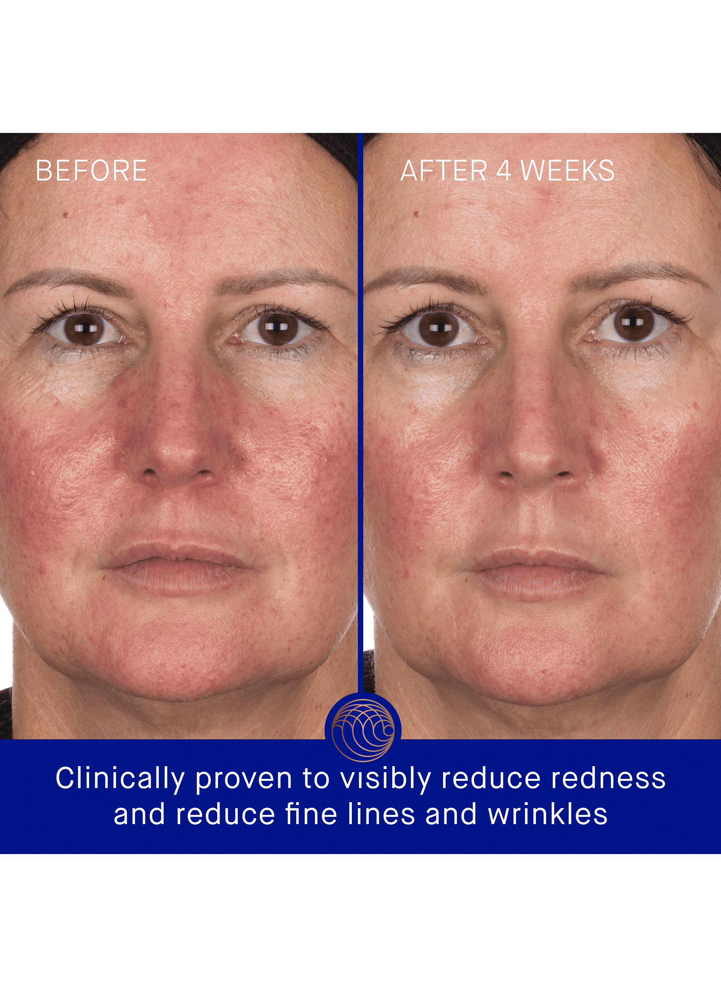 The Hydrogel Face Mask Single AUGUSTINUS BADER No color