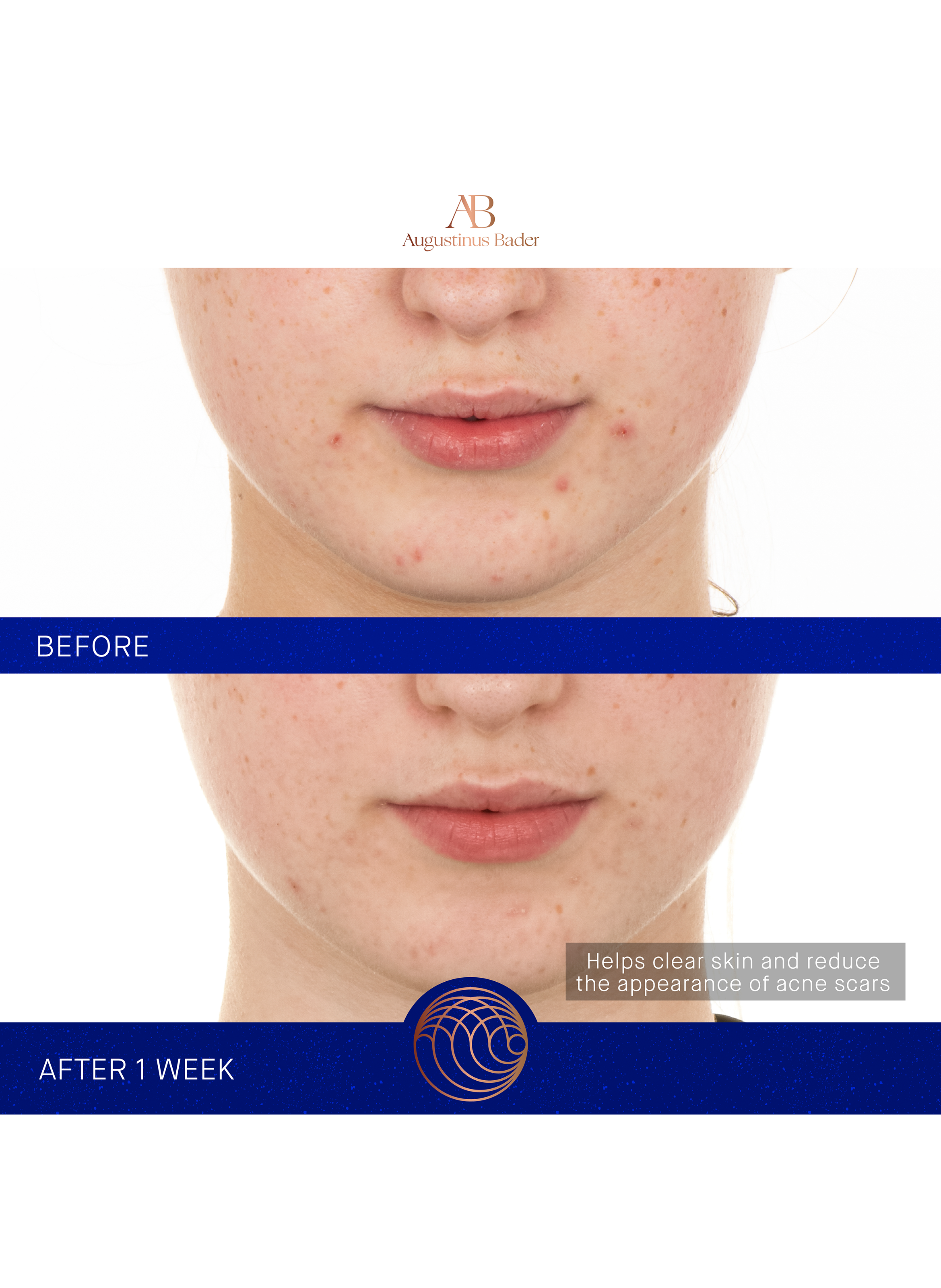 The Retinol Serum AUGUSTINUS BADER No color