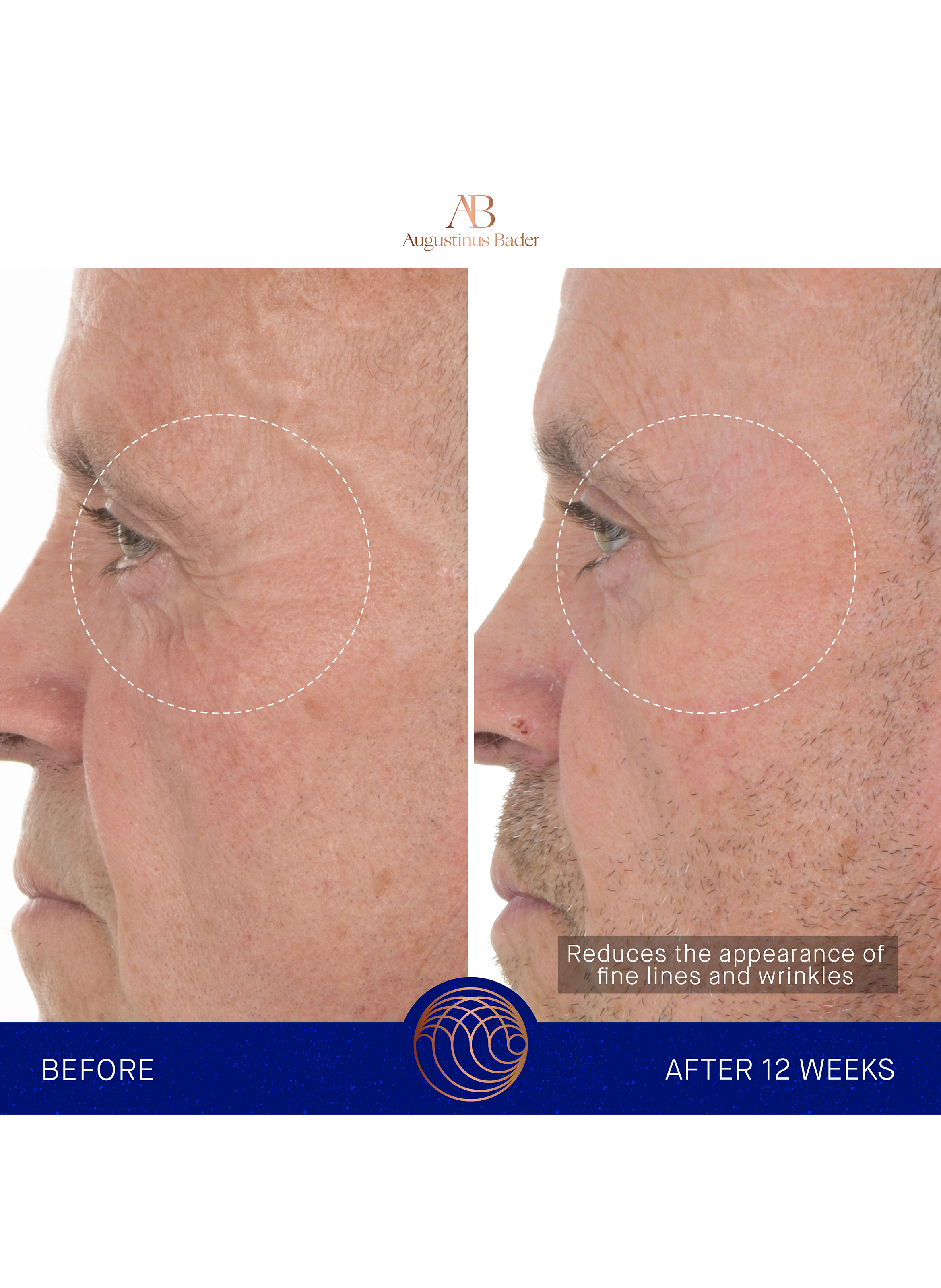 The Retinol Serum AUGUSTINUS BADER No color