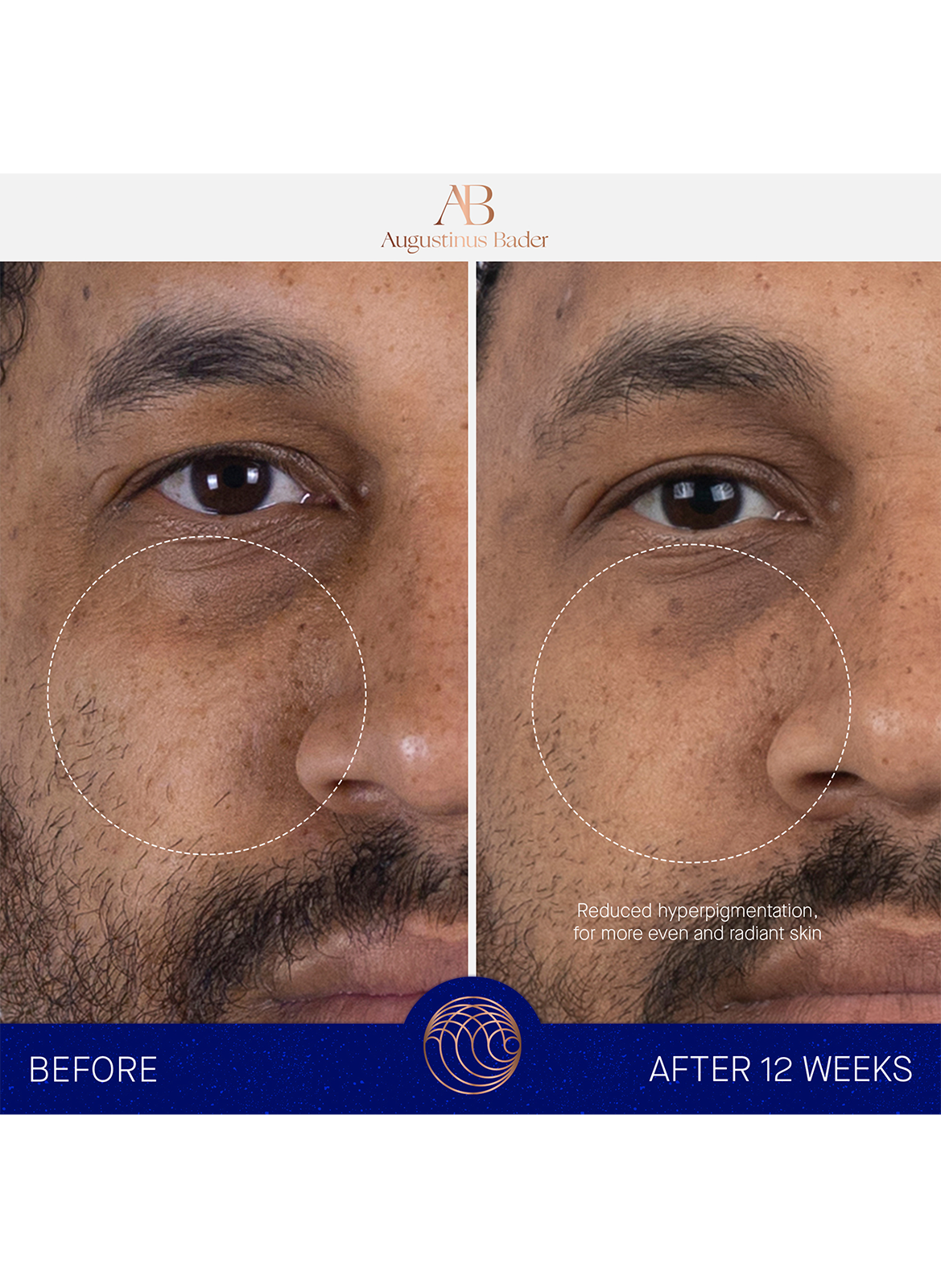 The Serum - Complete Set AUGUSTINUS BADER No color