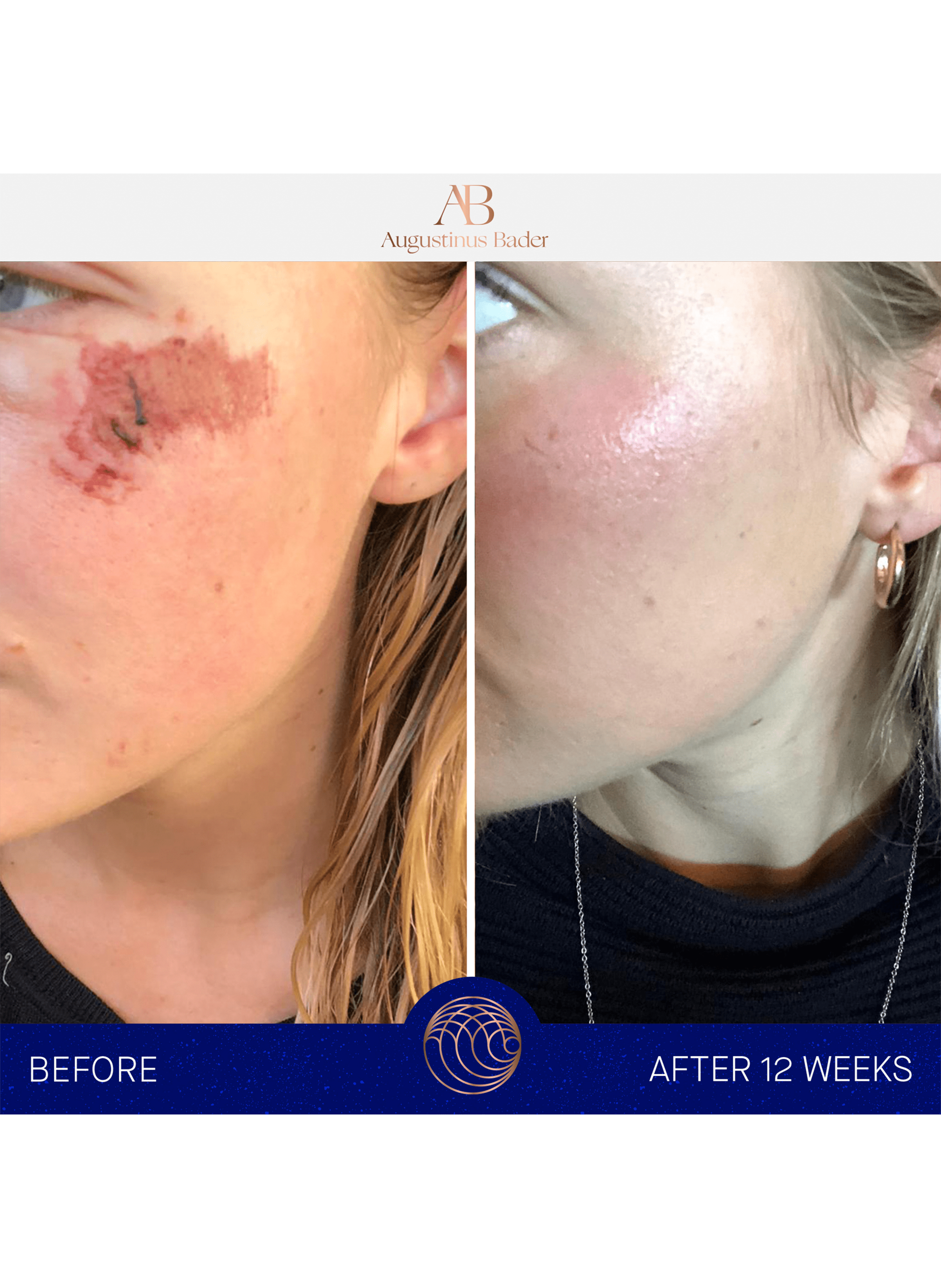 The cream AUGUSTINUS BADER No color