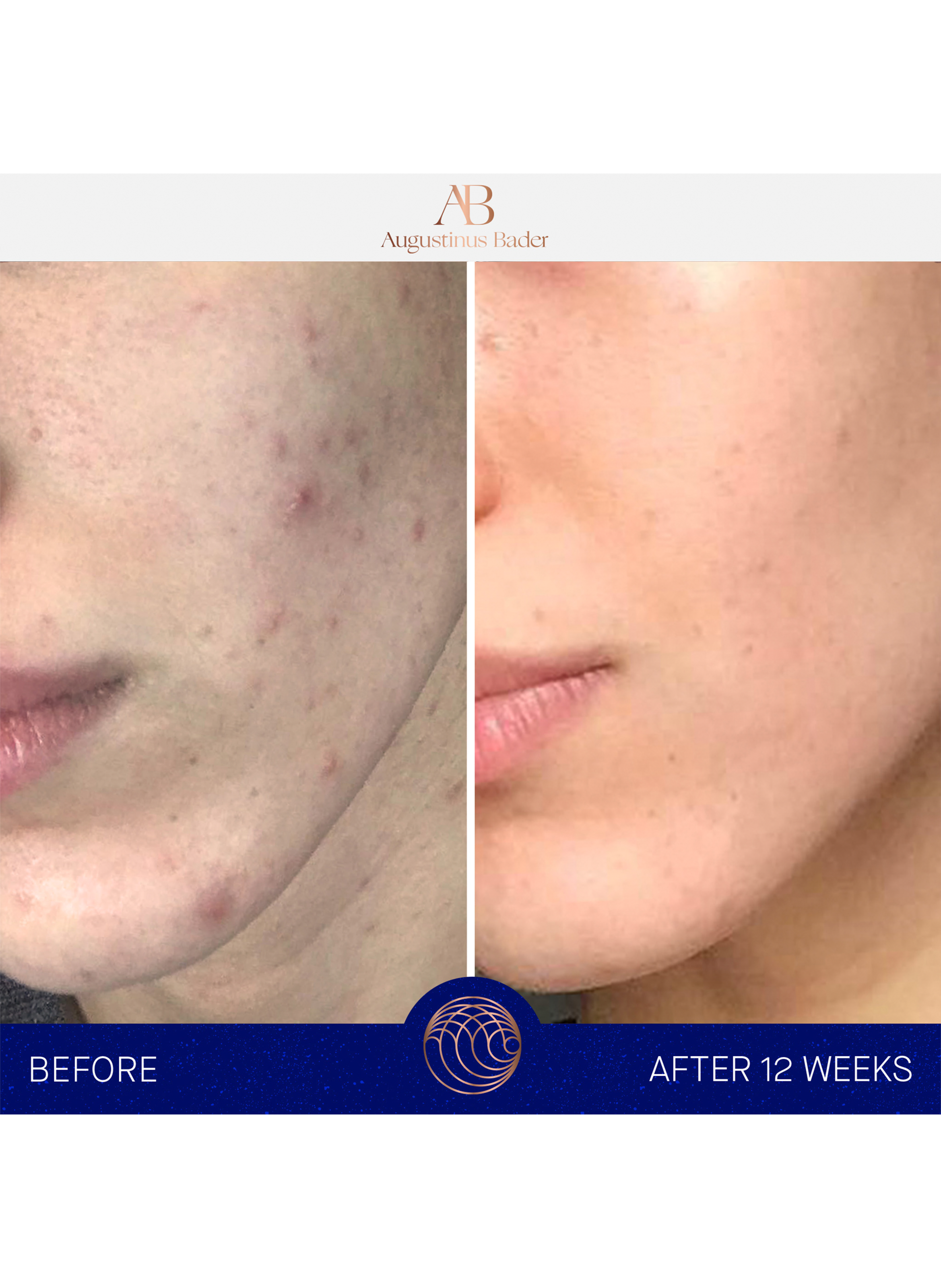 The cream AUGUSTINUS BADER No color