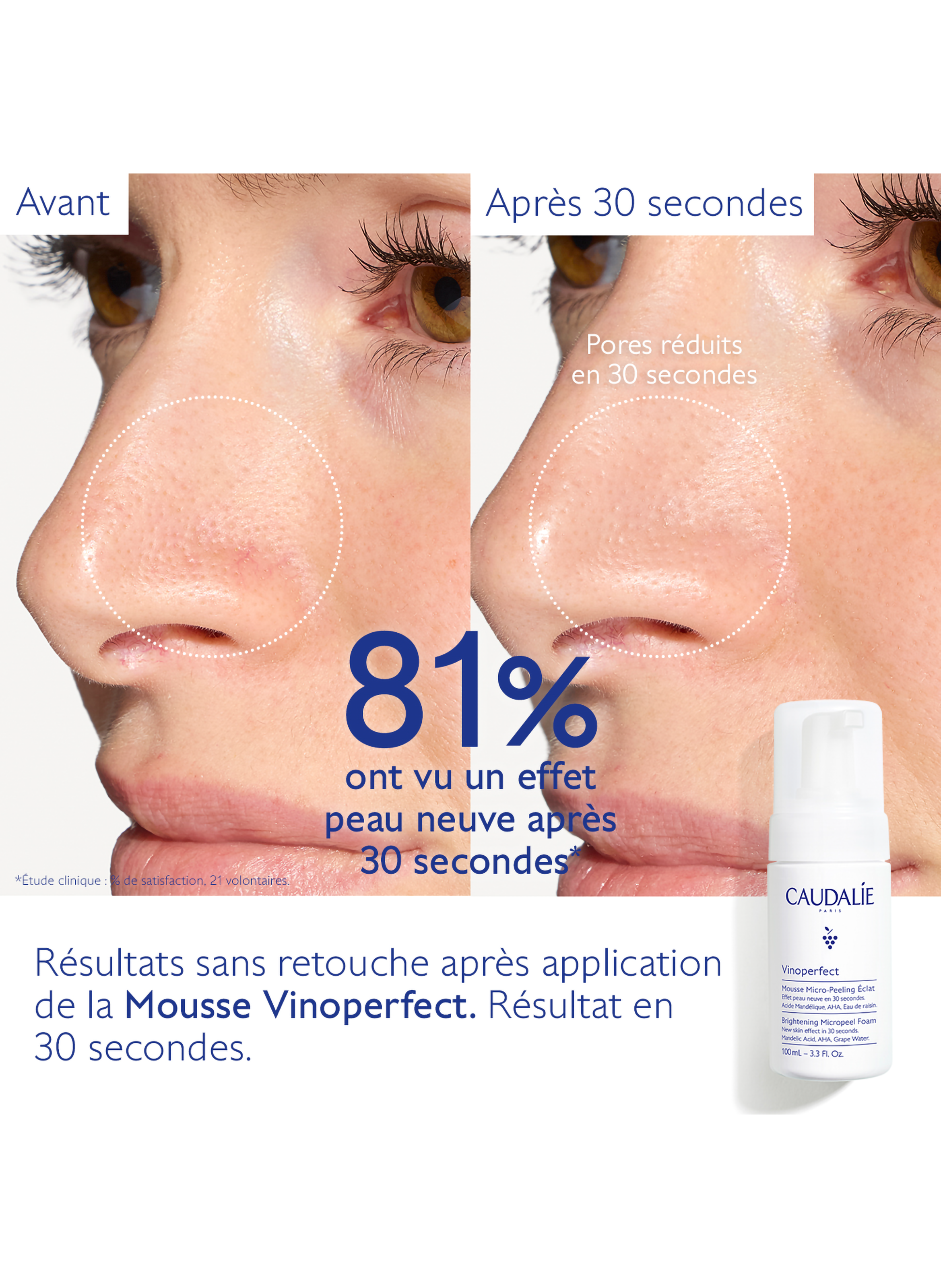Vinoperfect Radiance Revealing Micro-Peeling Mousse CAUDALIE No color