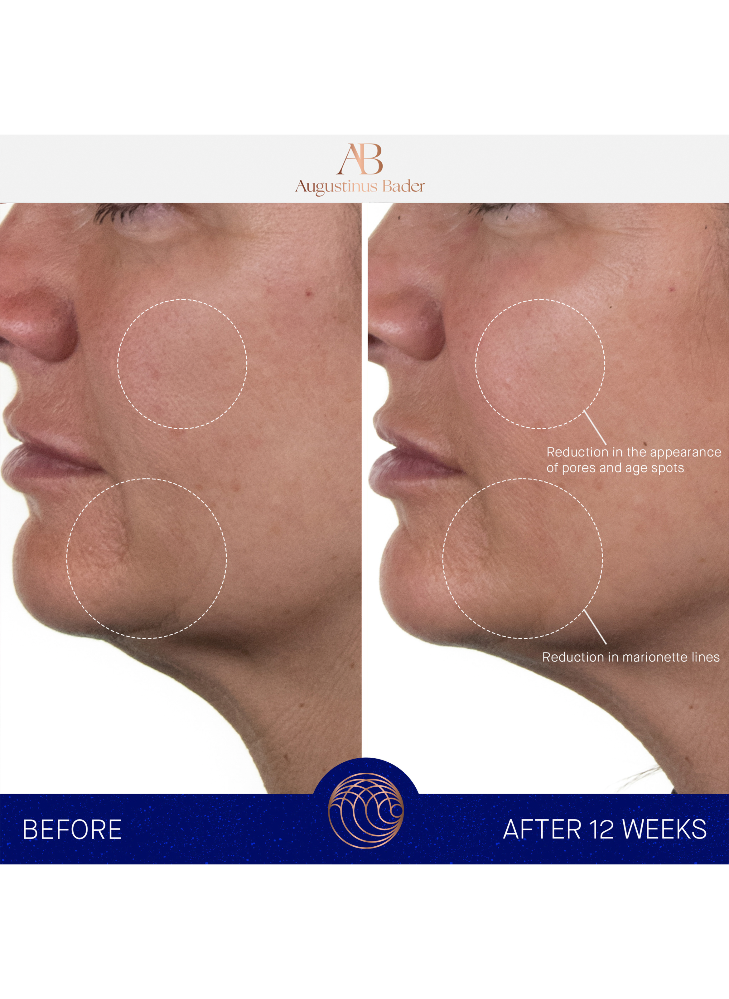 The Rich Cream AUGUSTINUS BADER No color