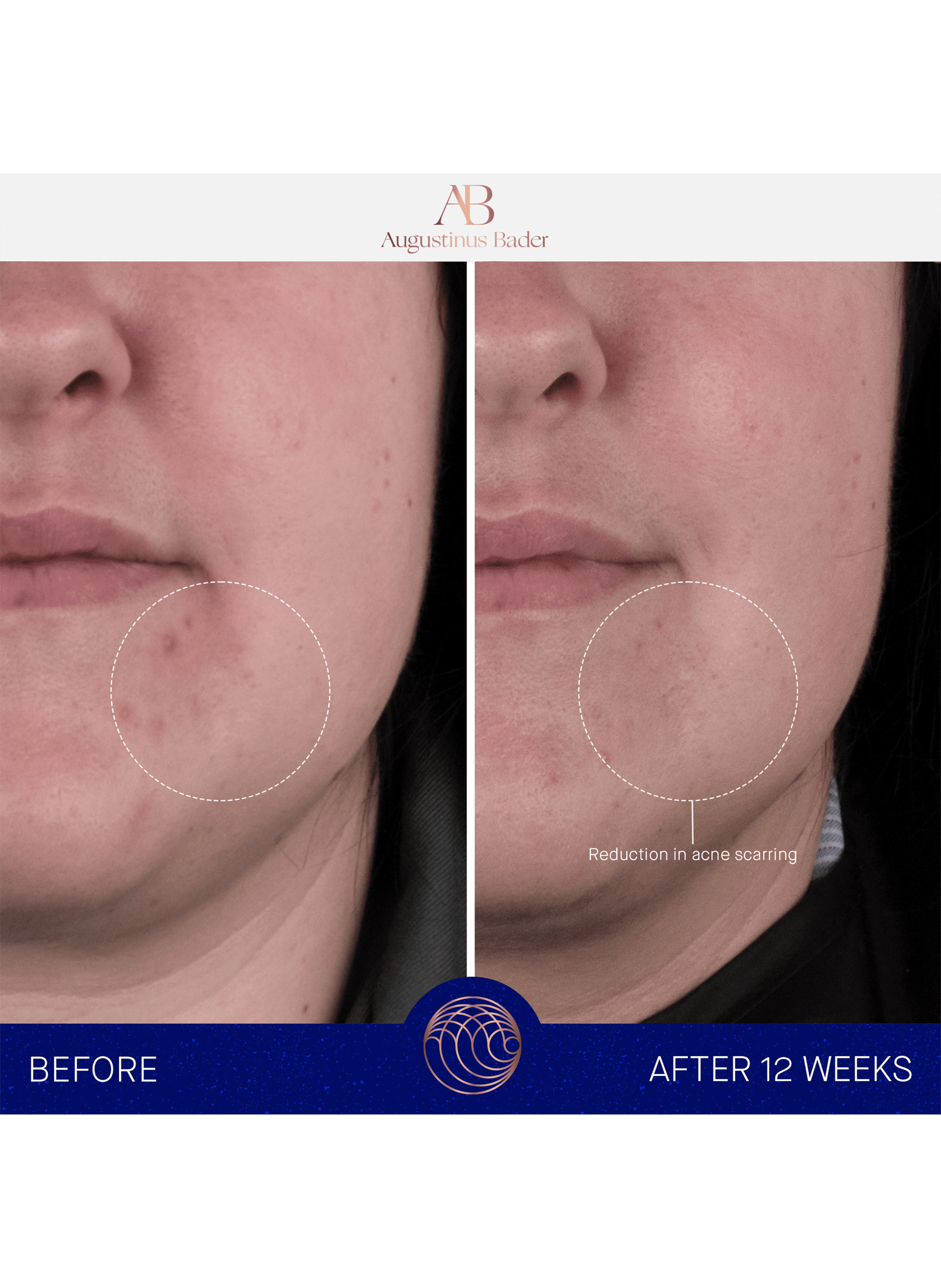 The Rich Cream AUGUSTINUS BADER No color