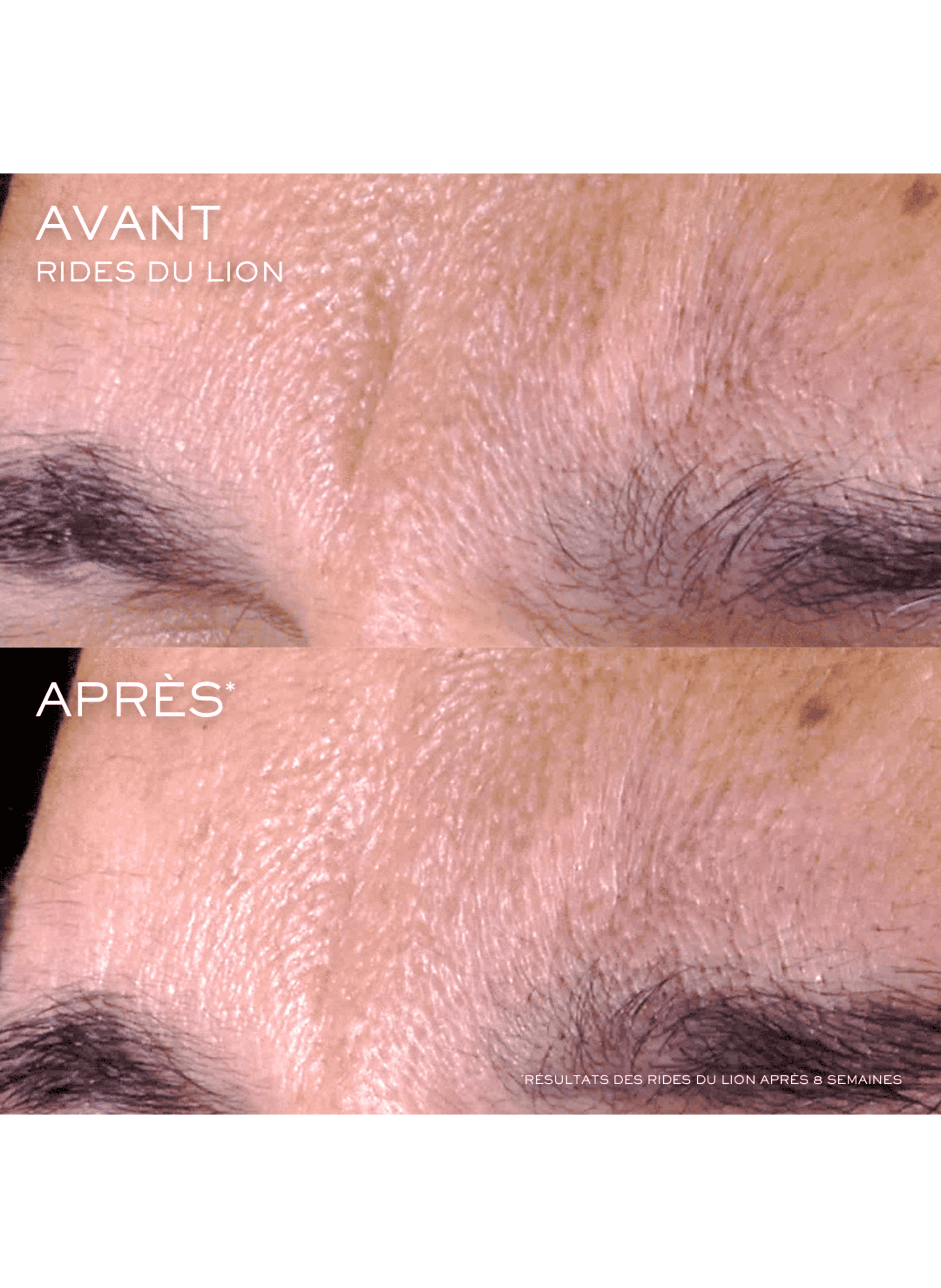 Le Renergie - Sérum visage LANCÔME No color