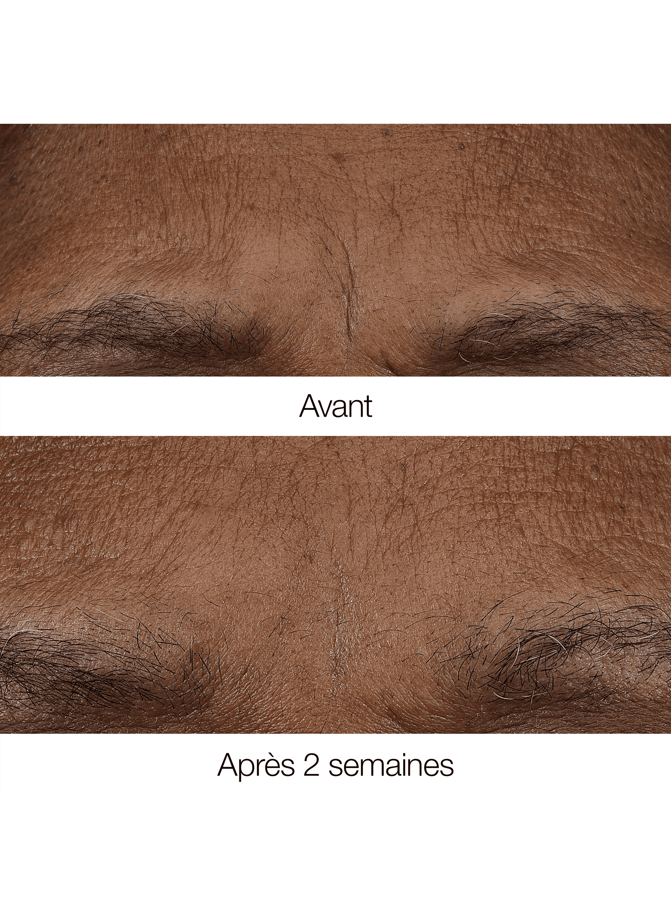 Smart Clinical Repair™ - Baume Rétinoïde Anti-rides Matin/Soir CLINIQUE No color