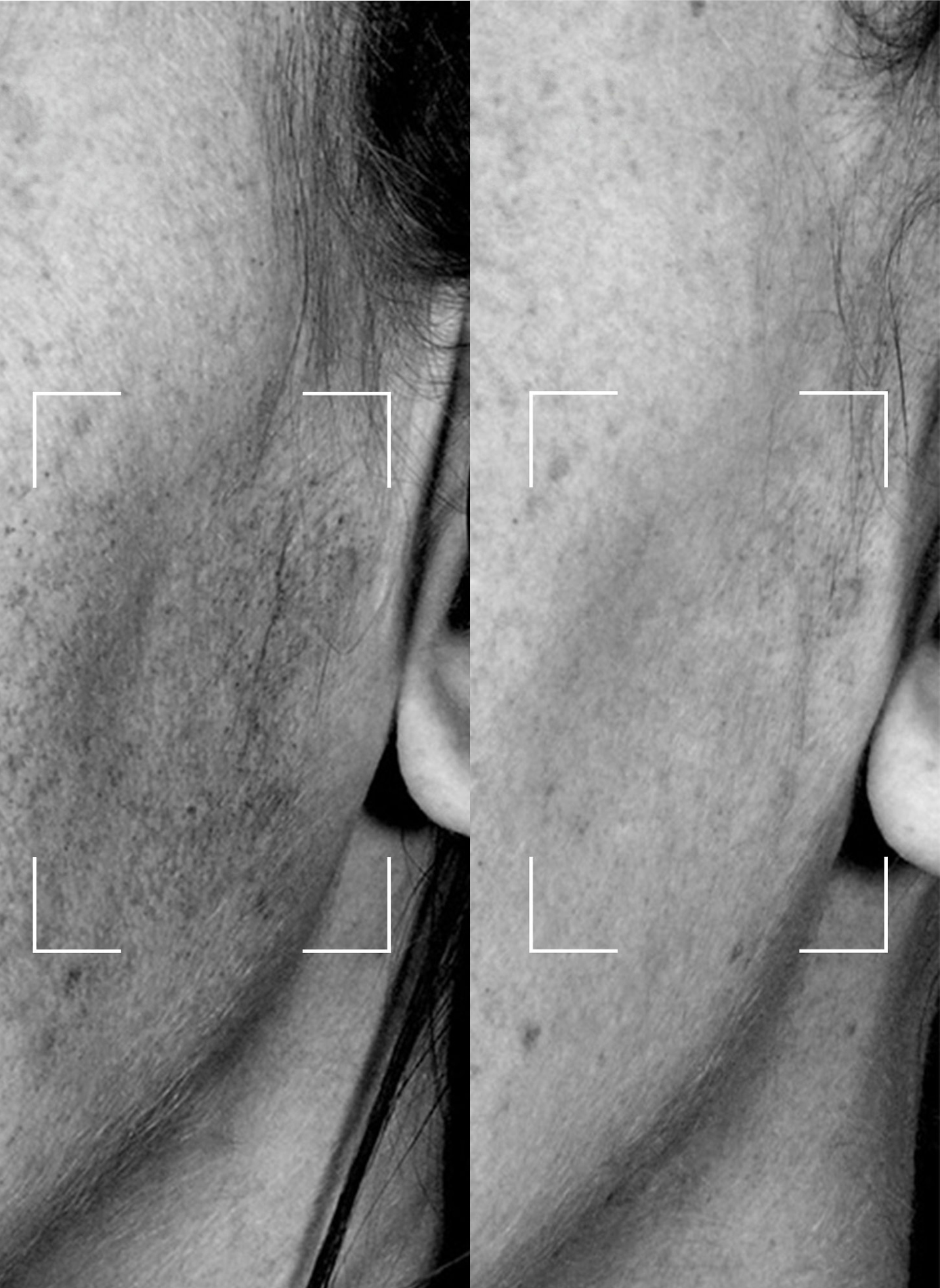 Capsules BRIGHTENING – Sérum Illuminateur à lumière LED LIGHTINDERM No color