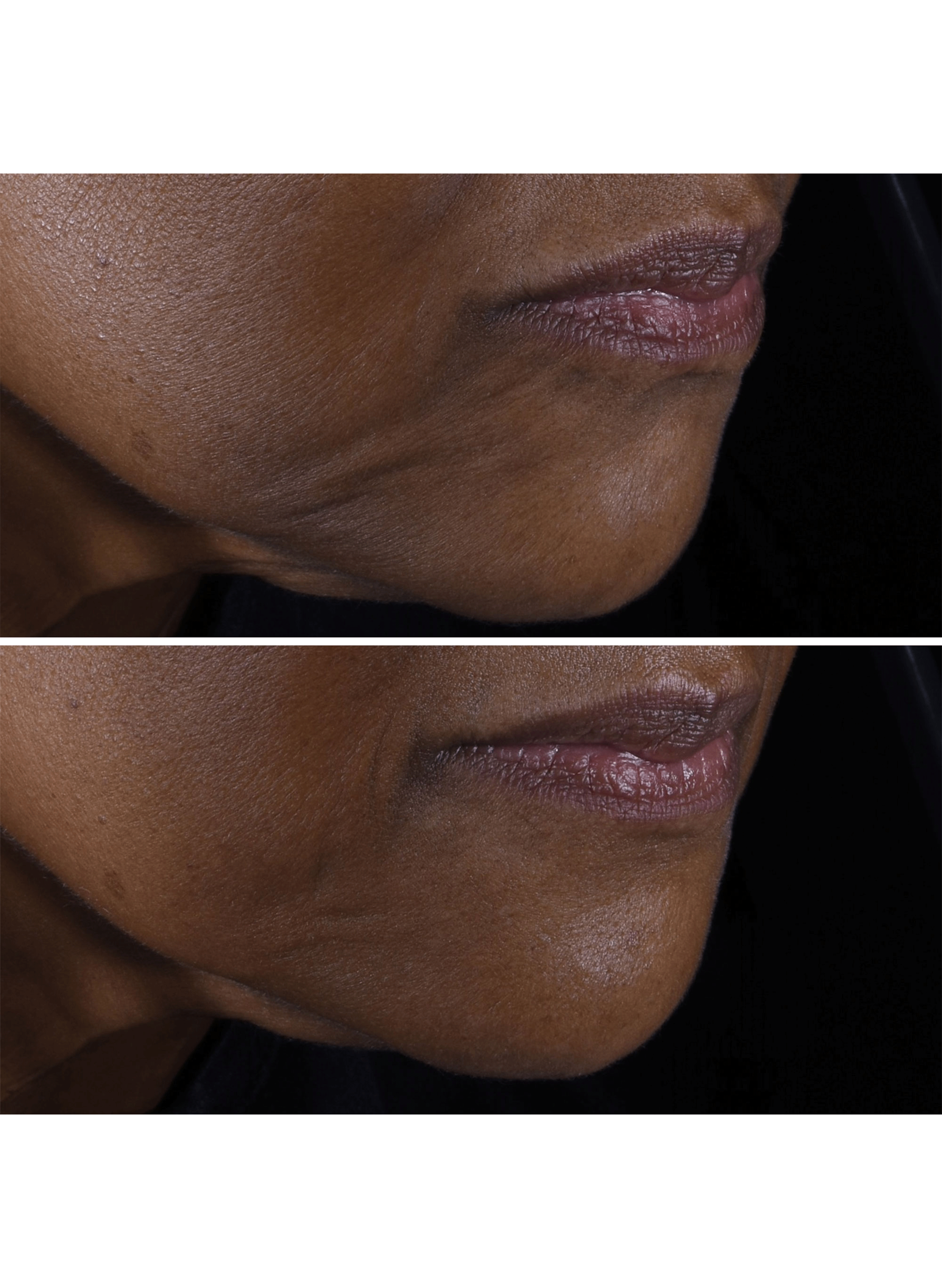 Smart Clinical Repair(TM) Crème liftante CLINIQUE No color