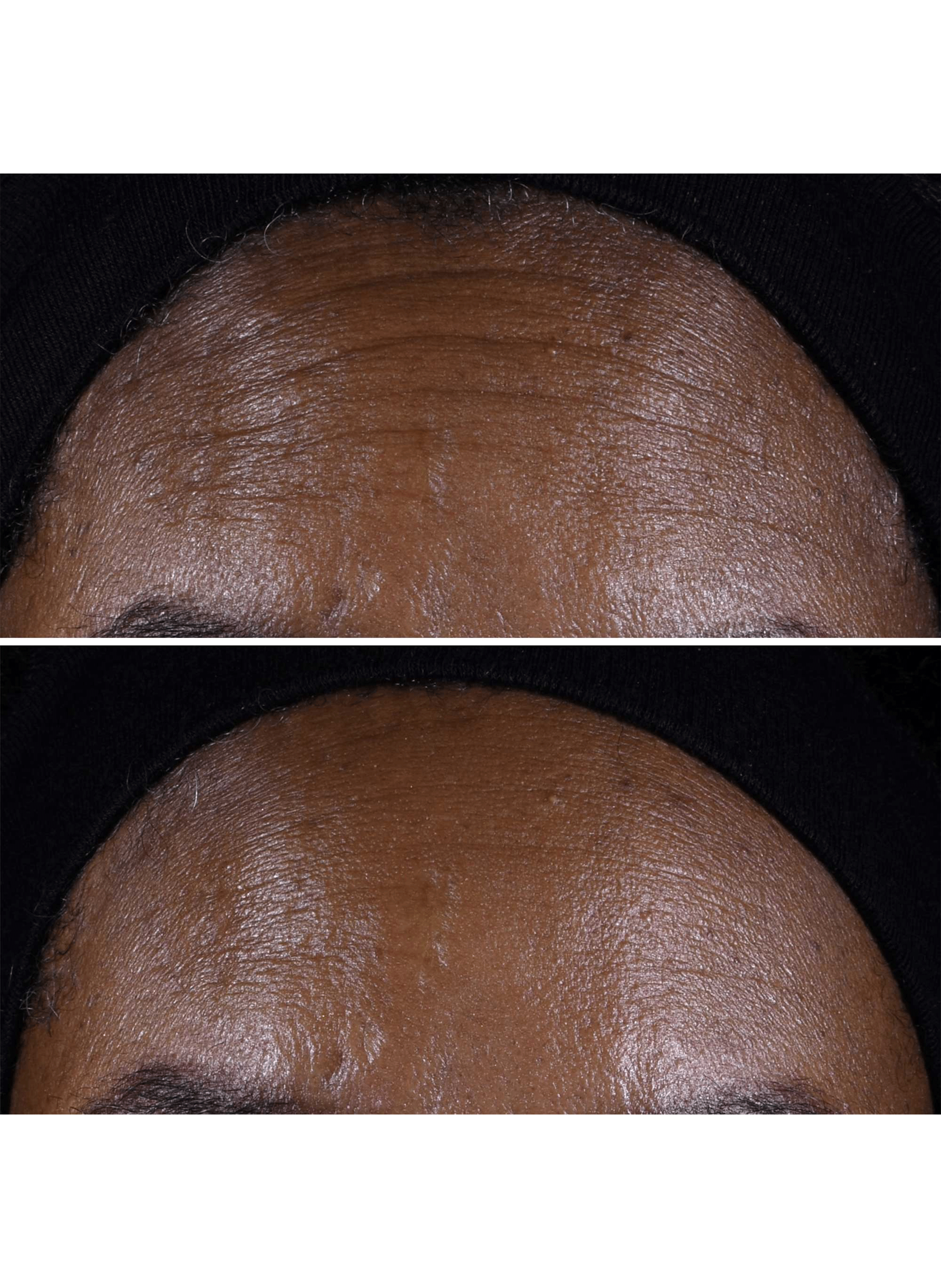 Smart Clinical Repair(TM) Crème liftante CLINIQUE No color