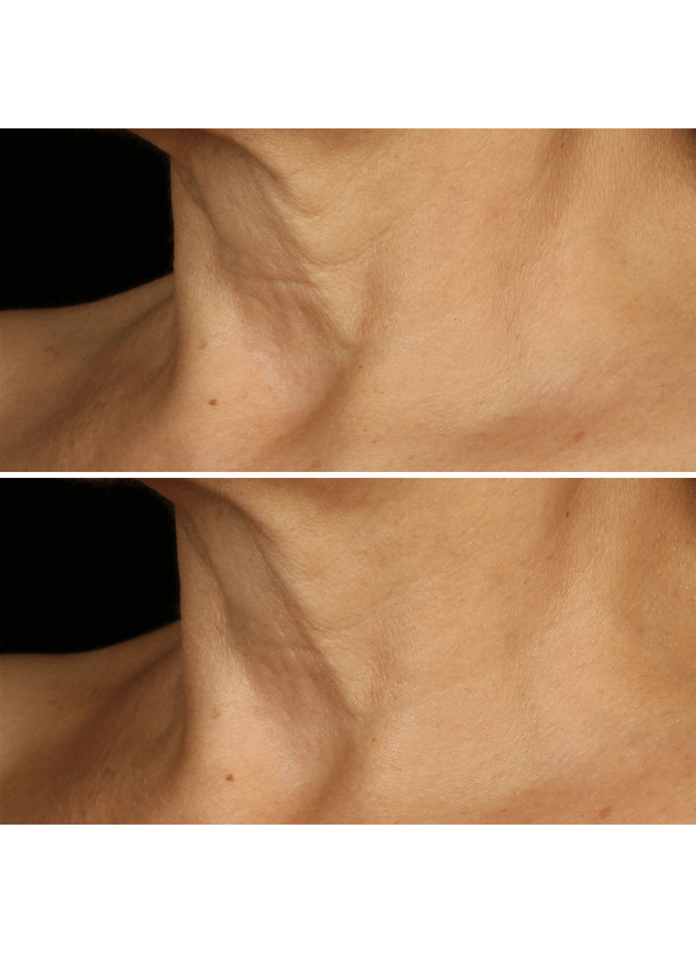 Smart Clinical Repair(TM) Crème liftante CLINIQUE No color