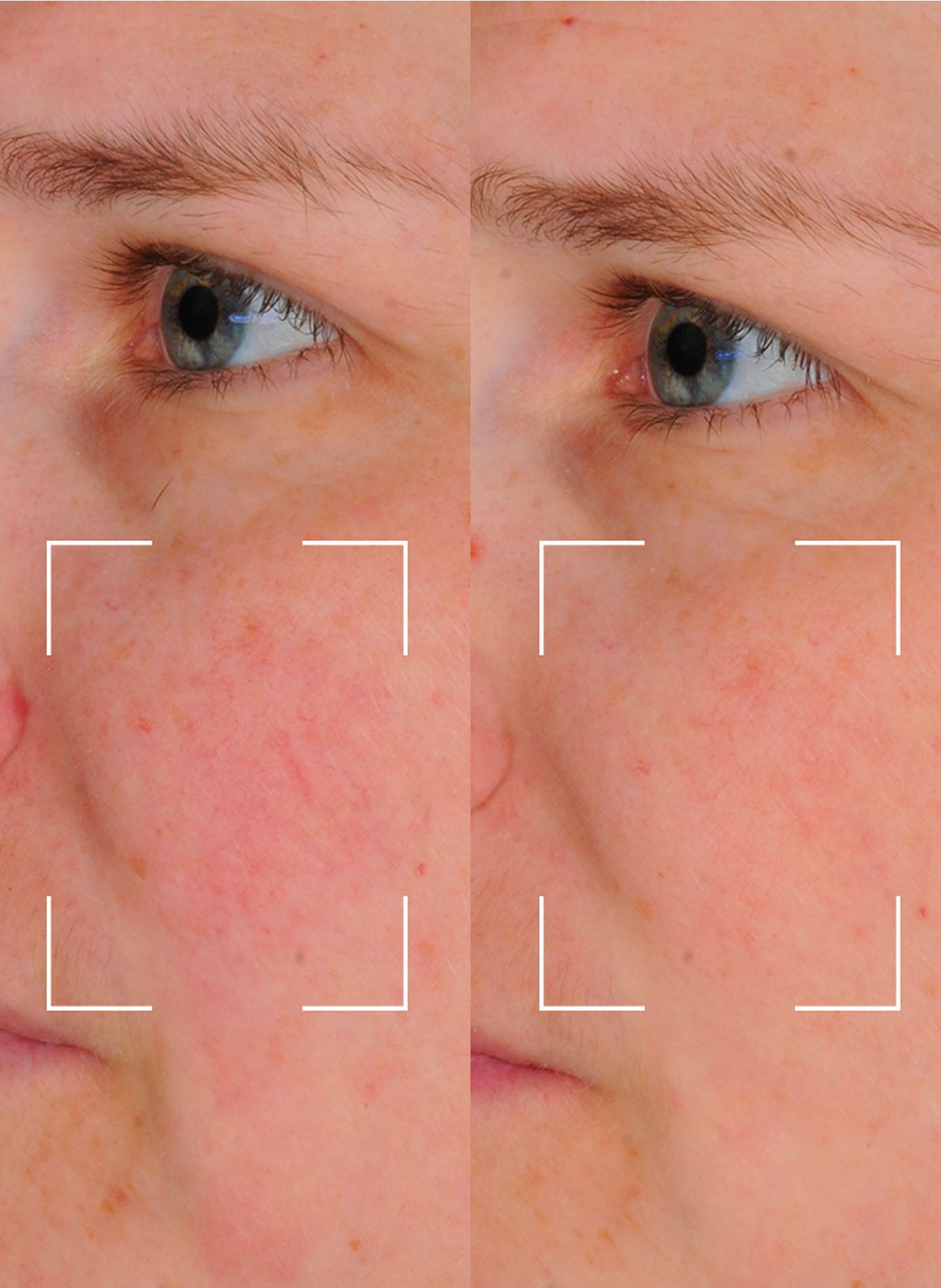 Capsules SKIN PERFECT – Sérum Perfecteur Hydratant à lumière LED LIGHTINDERM No color